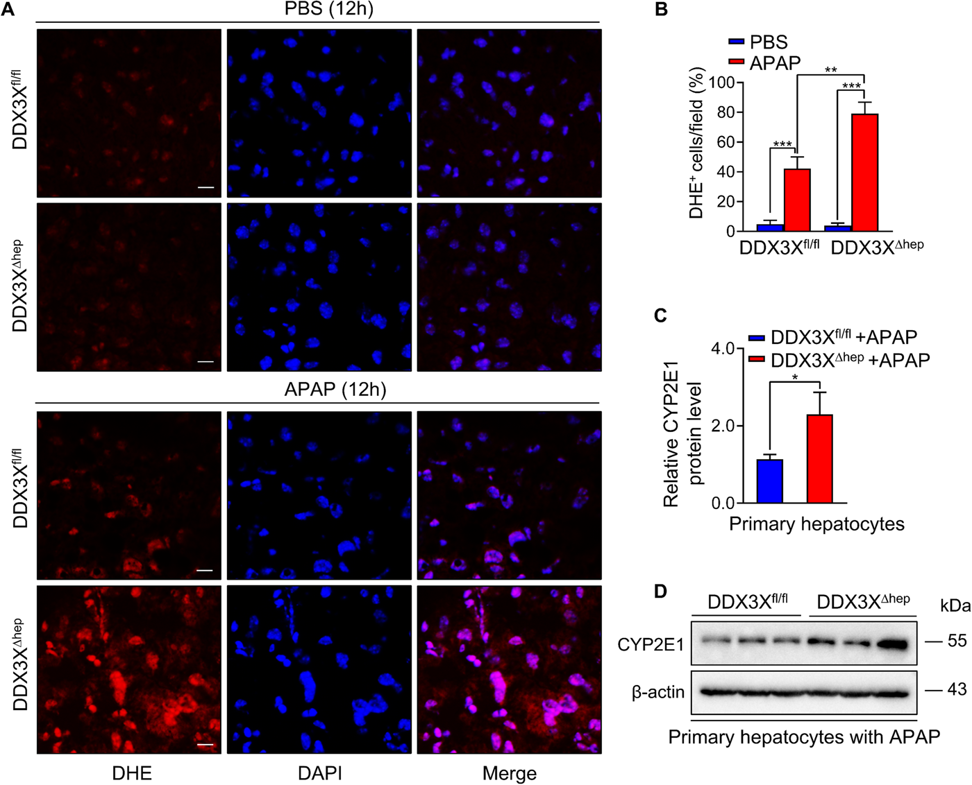 Fig. 5: Hepatocyte DDX3X ablation induces oxidative stress in DILI.