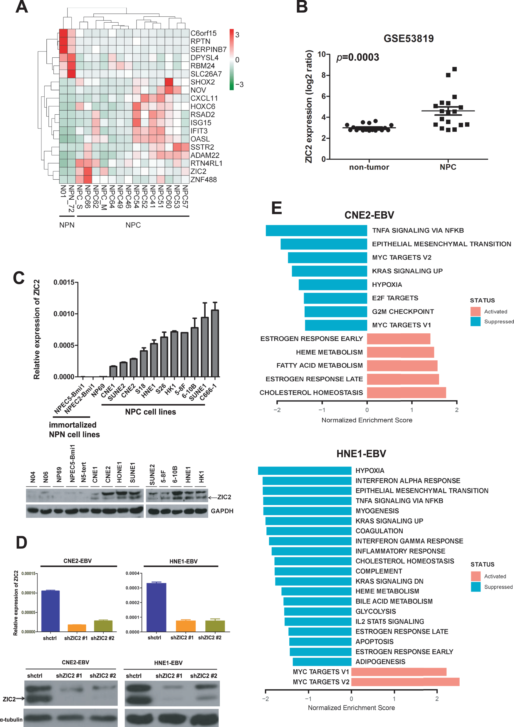 Fig. 1: ZIC2 was highly expressed in nasopharyngeal carcinoma.