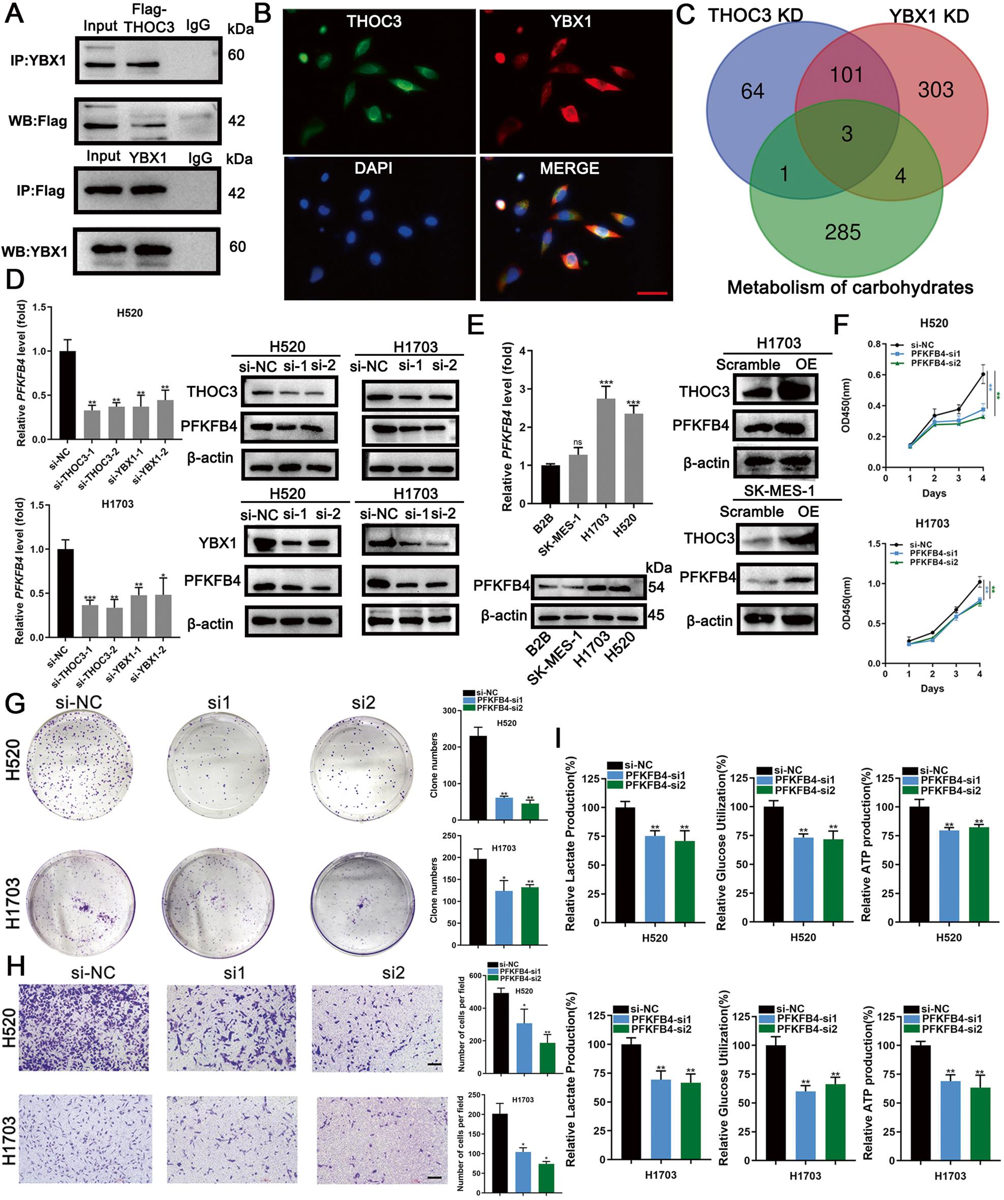 Fig. 5: THOC3 promotes LUSC partially through PFKFB4 by binding to YBX1.