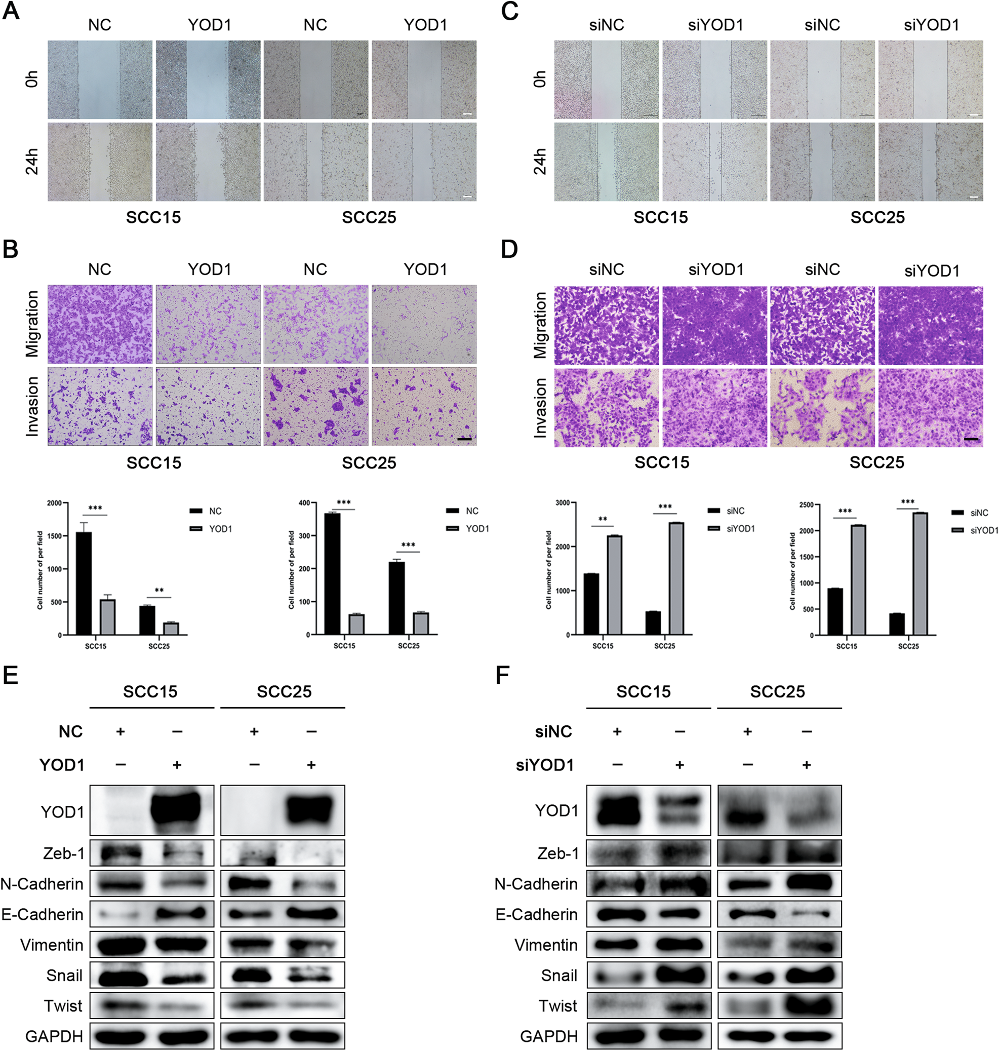 Fig. 3: YOD1 inhibits the migration and invasion of HNSCC cells in vitro.
