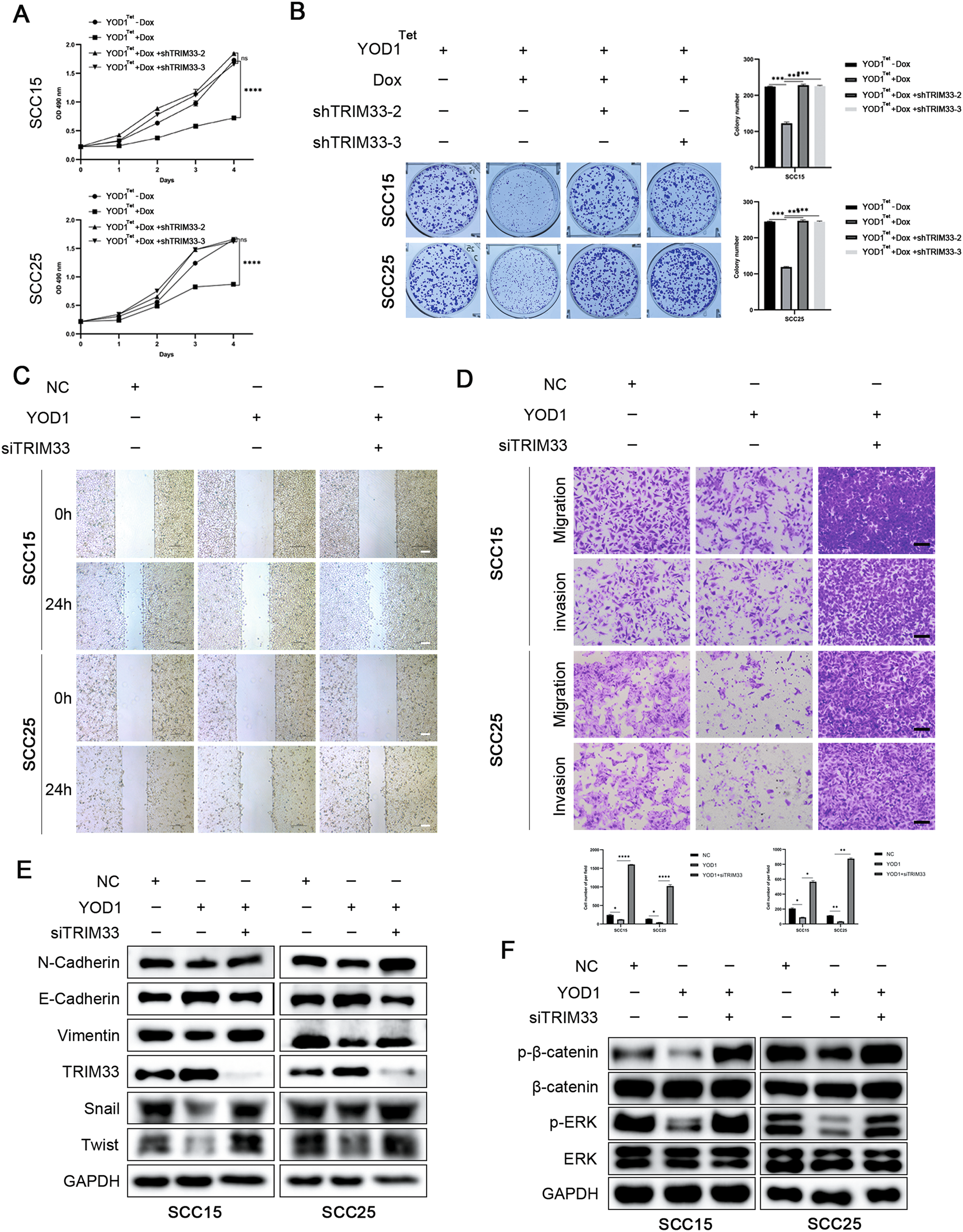 Fig. 5: YOD1 inhibits malignant progression of HNSCC by regulating TRIM33.