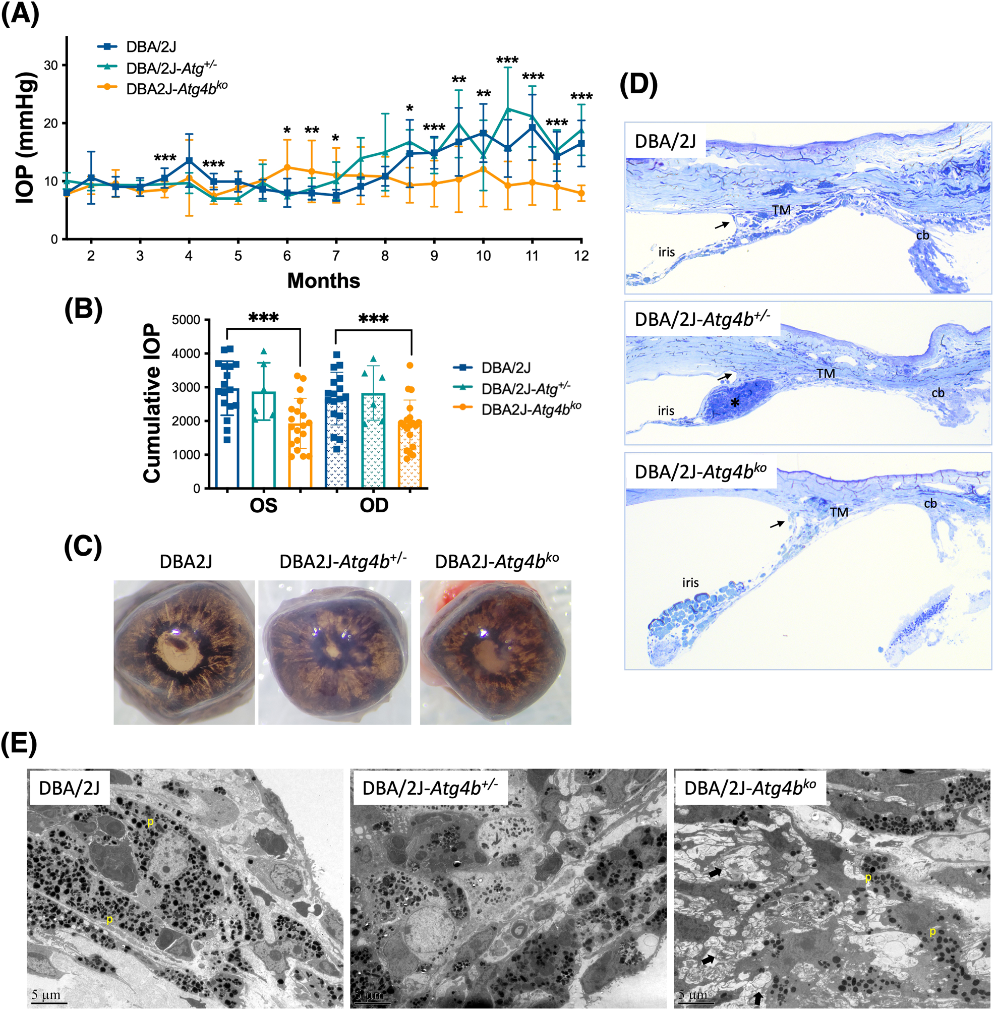 Autophagy deficiency protects against ocular hypertension and  neurodegeneration in experimental and spontaneous glaucoma mouse models