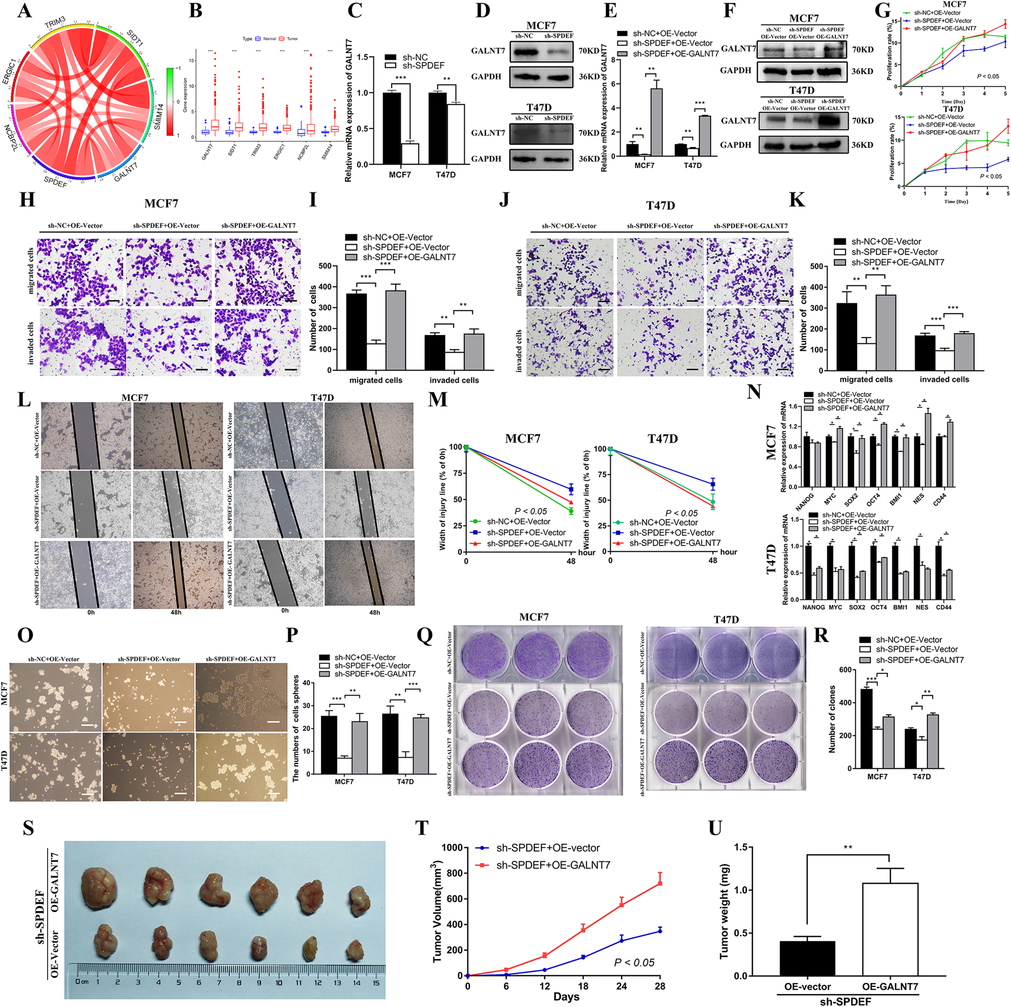 Fig. 4: SPDEF was involved in cancer stem cell-like characteristics and tumorigenesis by directly regulating GALNT7 expression in luminal BC.