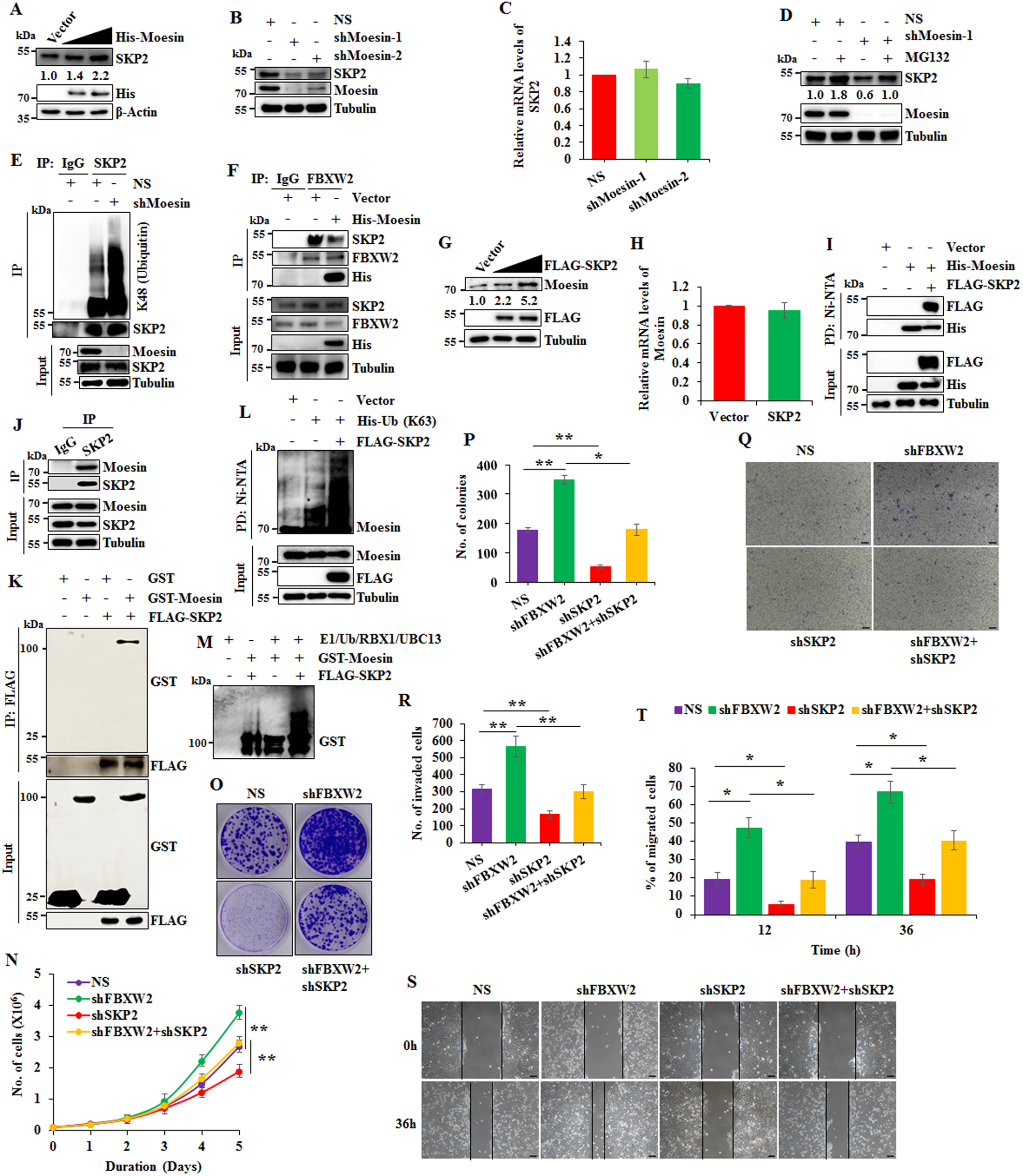 Fig. 5: Moesin and SKP2 interact with and positively regulate each other’s expression at the posttranscriptional level.