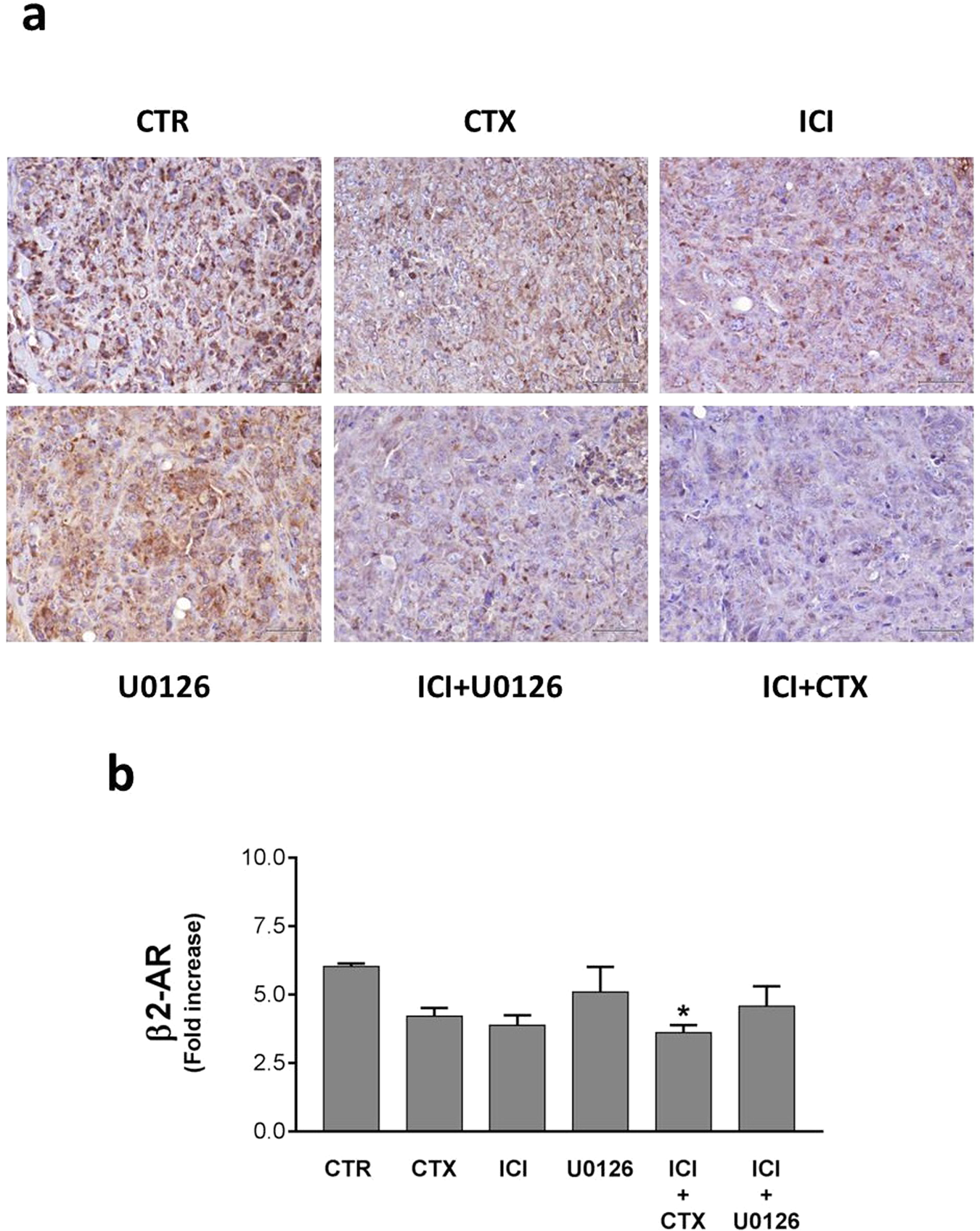 Fig. 3: β2-AR expression in HNSCC mouse model.