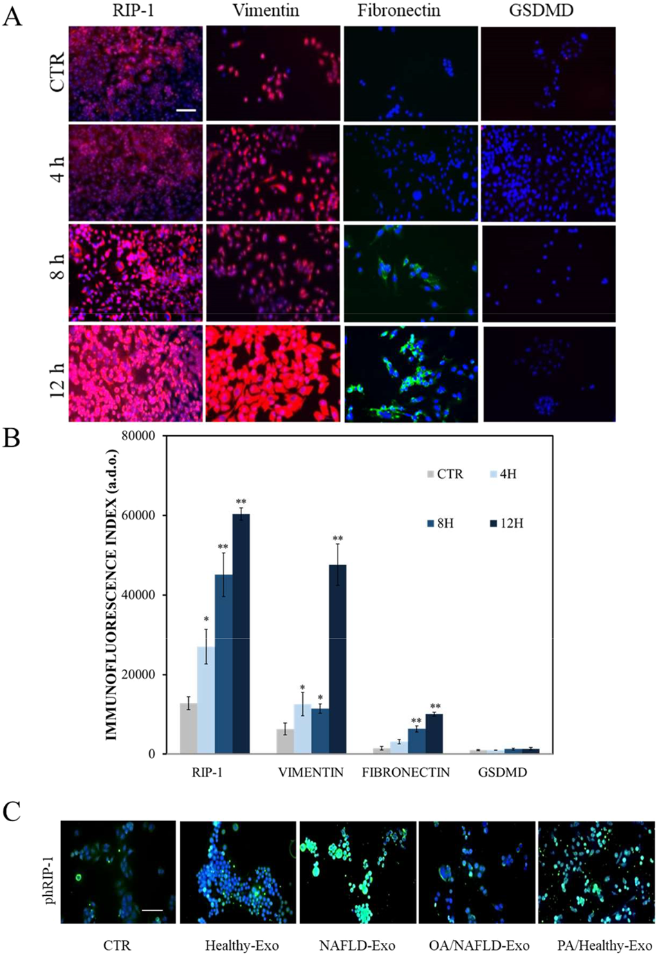 Fig. 4: Detection of RIP-1, fibronectin, vimentin, GSDMD and phospho-RIP-1 in Hepa-RG cells by immunofluorescence confocal microscopy.