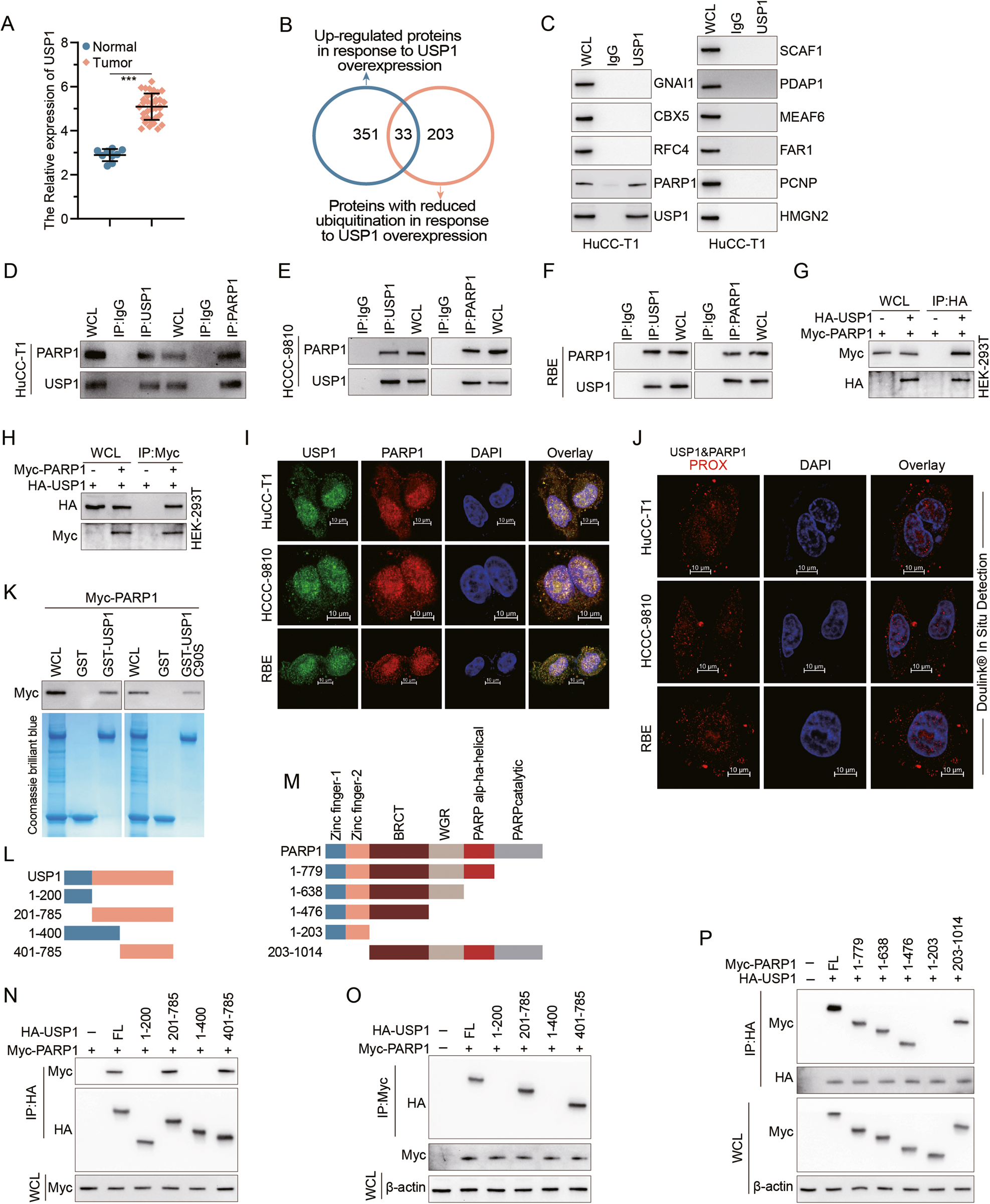 pimpandhost uploaded on 2016 " PM a 1 1 USP1 promotes cholangiocarcinoma progression by deubiquitinating PARP1 to prevent its proteasomal degradation | Cell Death & Disease