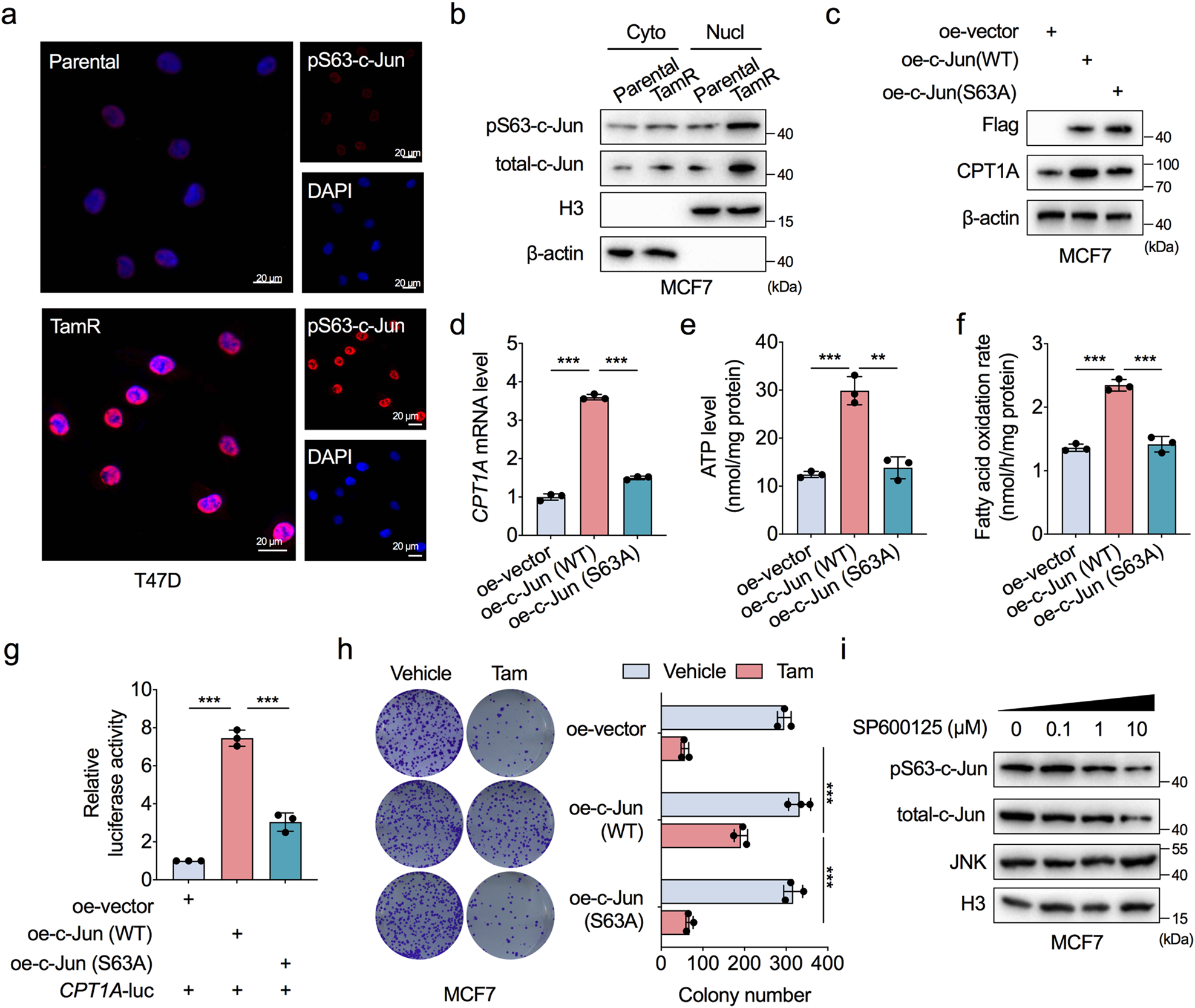 Fig. 5: JNK-dependent c-Jun phosphorylation activates FAO.
