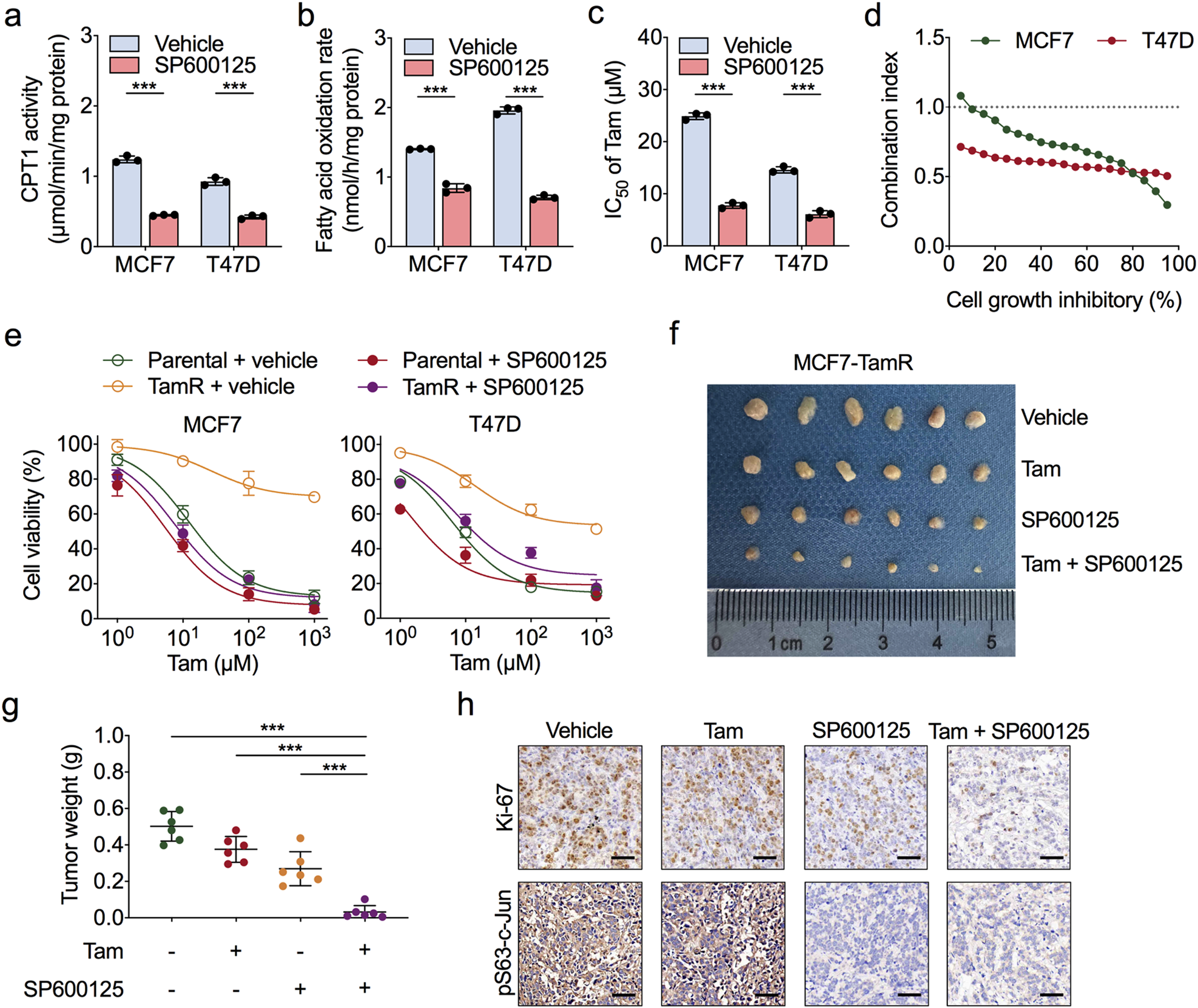 Fig. 6: JNK inhibitors sensitise ER-positive BC cells to tamoxifen by inhibiting c-Jun-induced FAO.