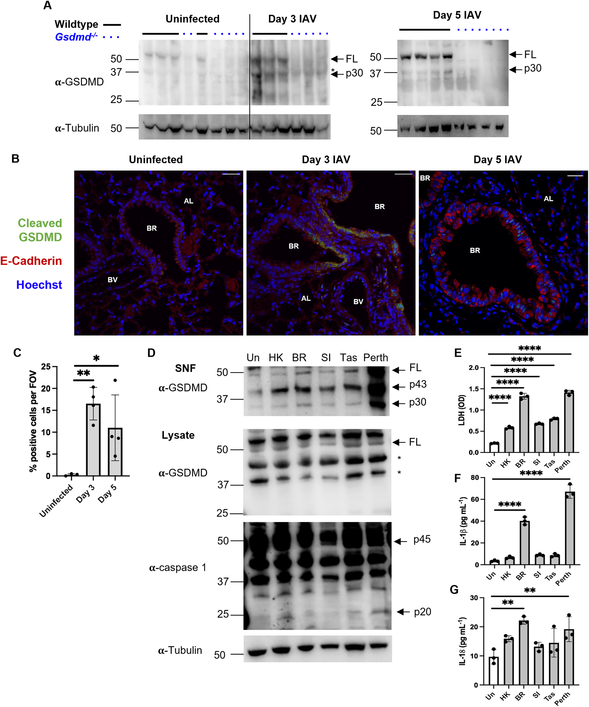 Gasdermin D promotes hyperinflammation and immunopathology during severe  influenza A virus infection | Cell Death & Disease