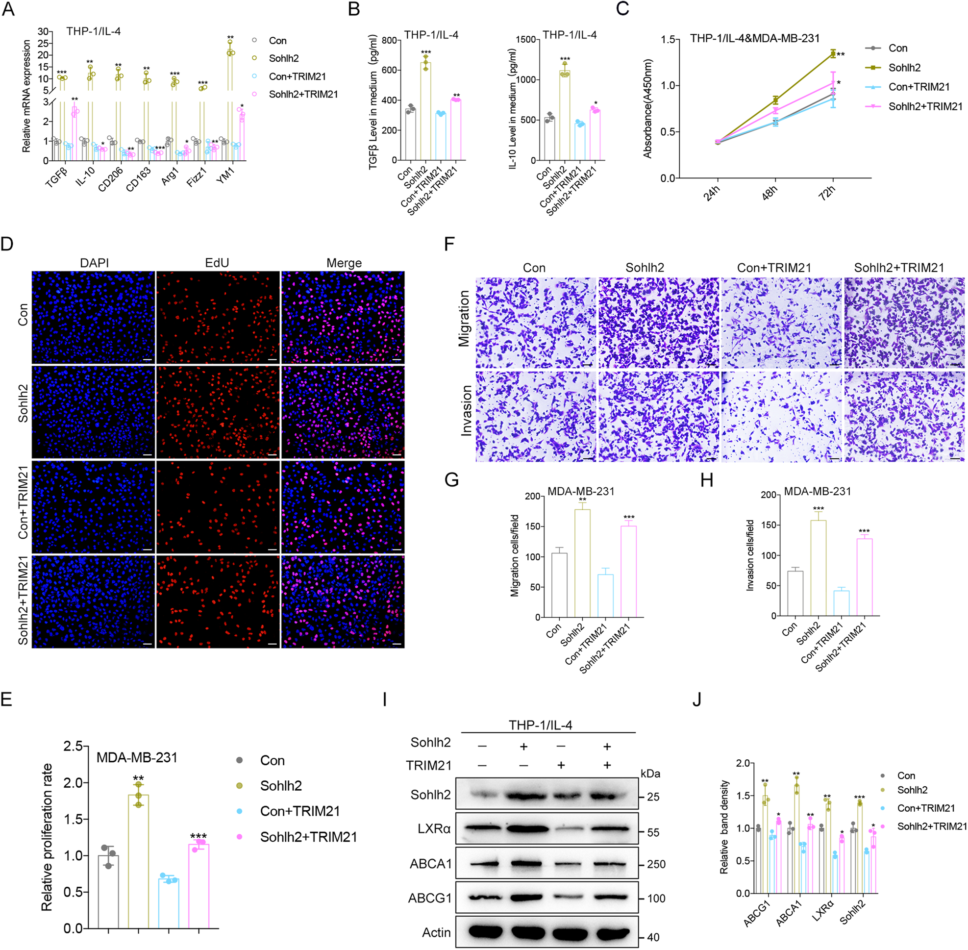 Fig. 7: TRIM21 suppresses M2 macrophage polarization and oncogenic properties of TNBC cells partly through a Sohlh2-dependent manner.