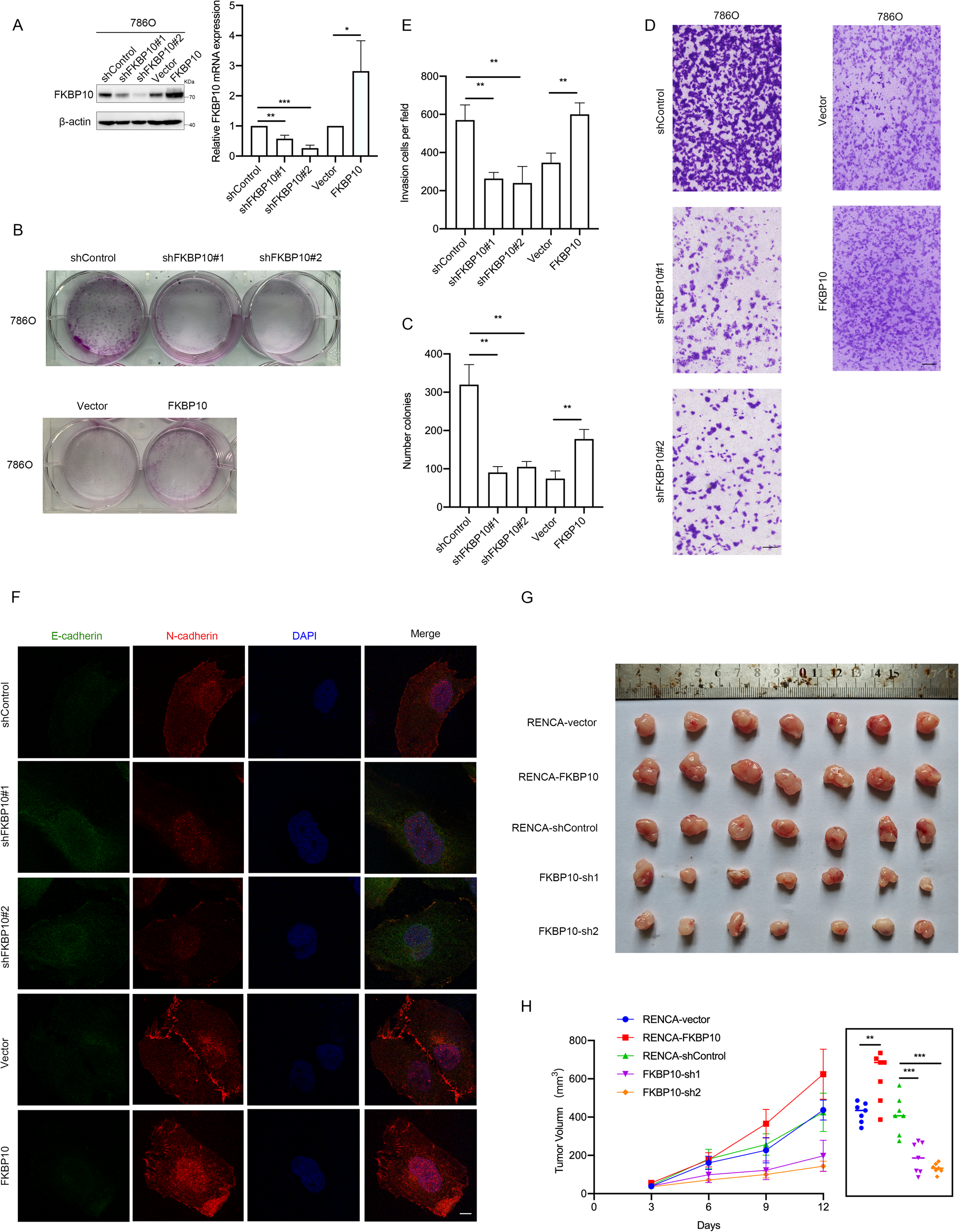 Fig. 2: FKBP10 promotes ccRCC proliferation, migration and invasion.