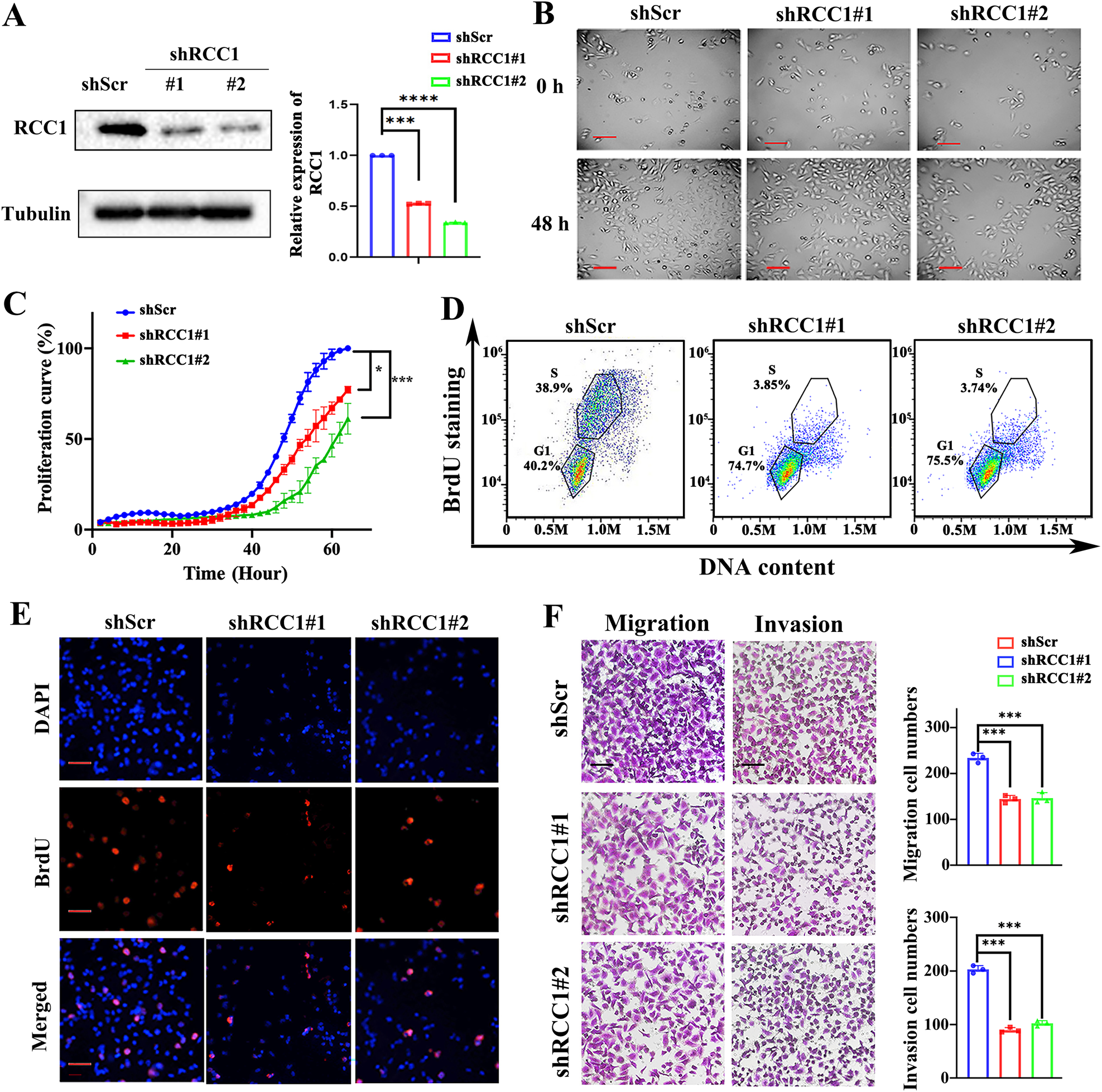 Fig. 2: Knockdown of RCC1 represses the cell growth and motility of STS cells.