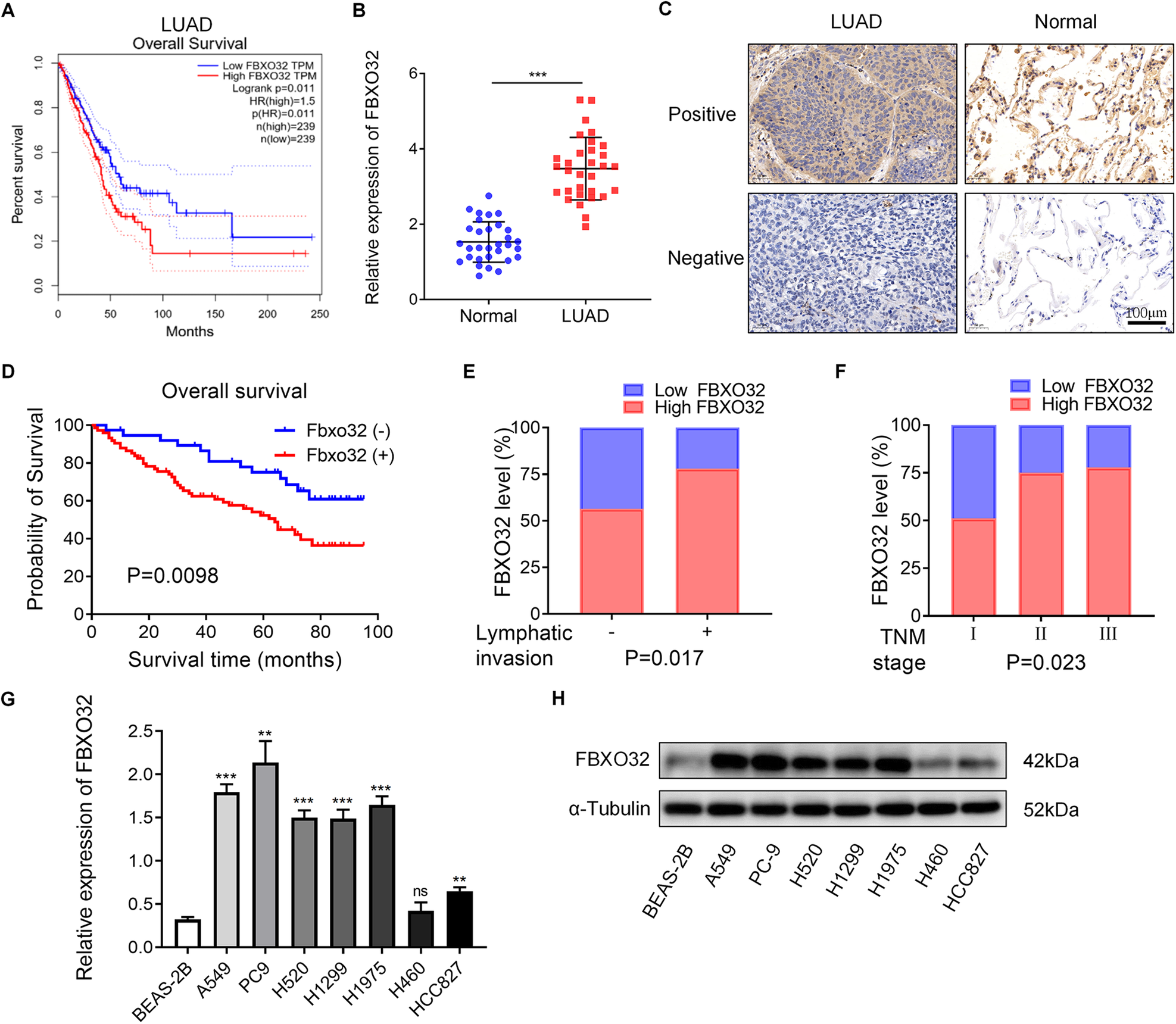 Fig. 1: FBXO32 is overexpressed in LUAD.