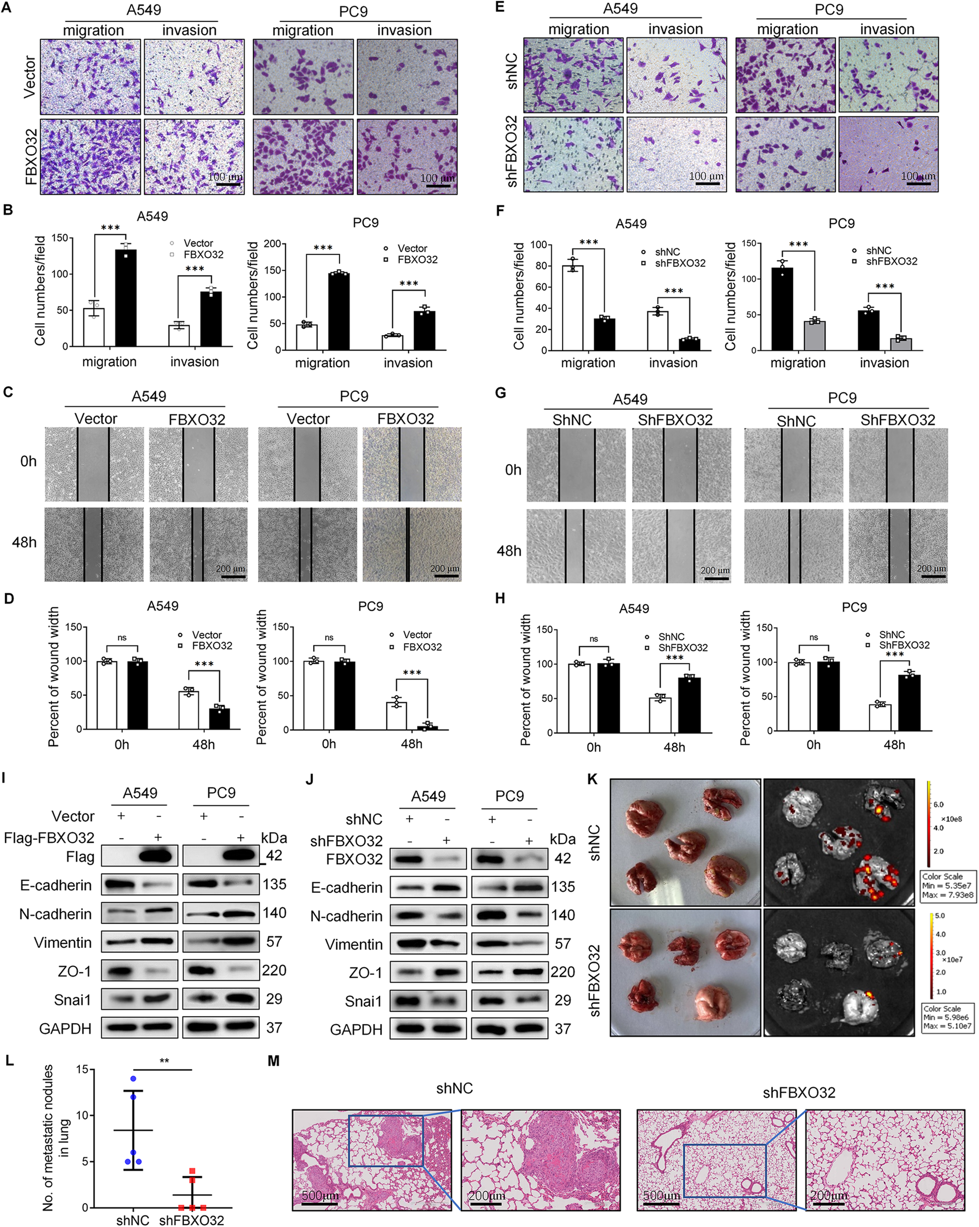 Fig. 2: FBXO32 regulates the migration and invasion of LUAD cells.