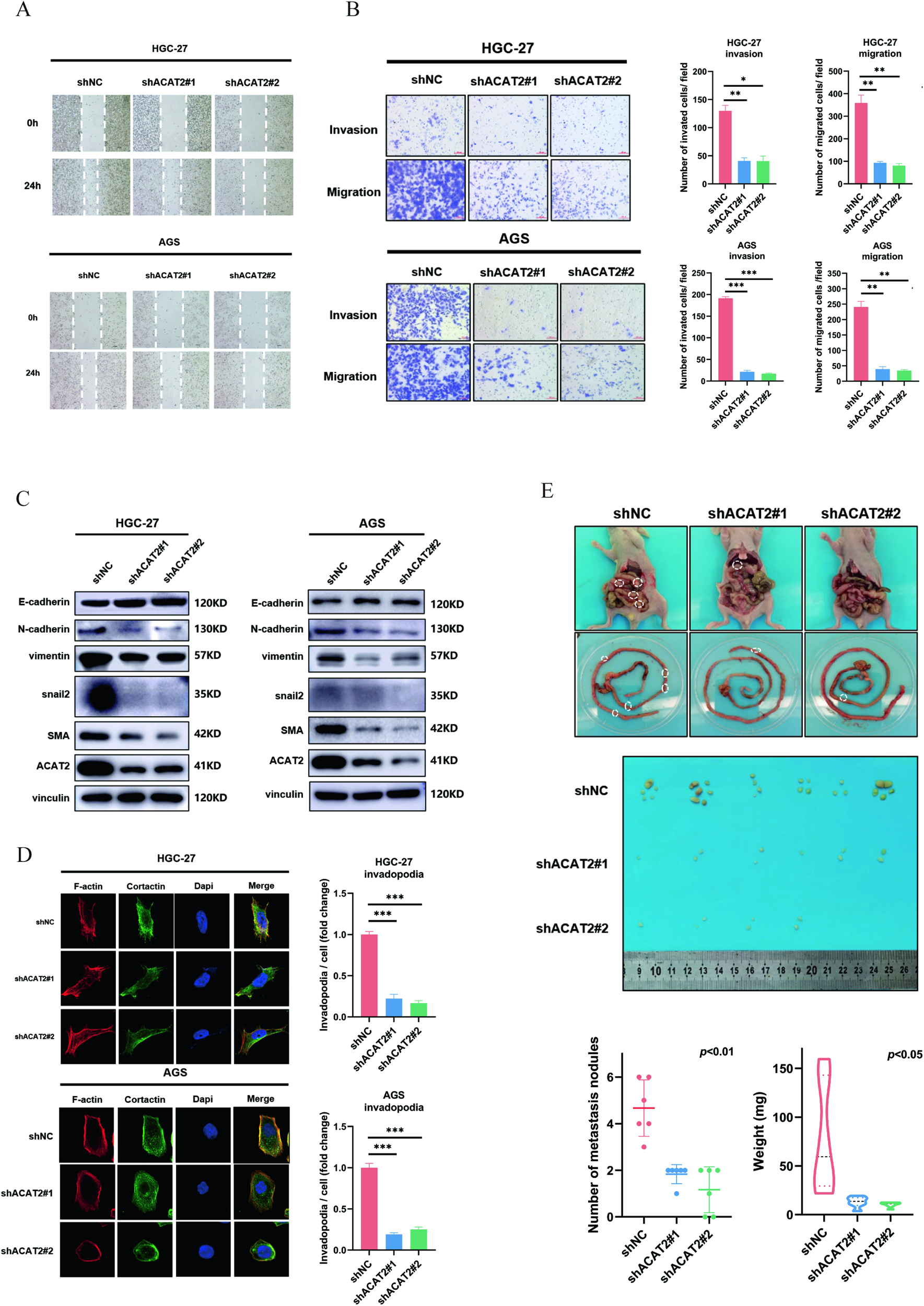 Fig. 3: ACAT2 expression potentially enhances the motility of GC cells.
