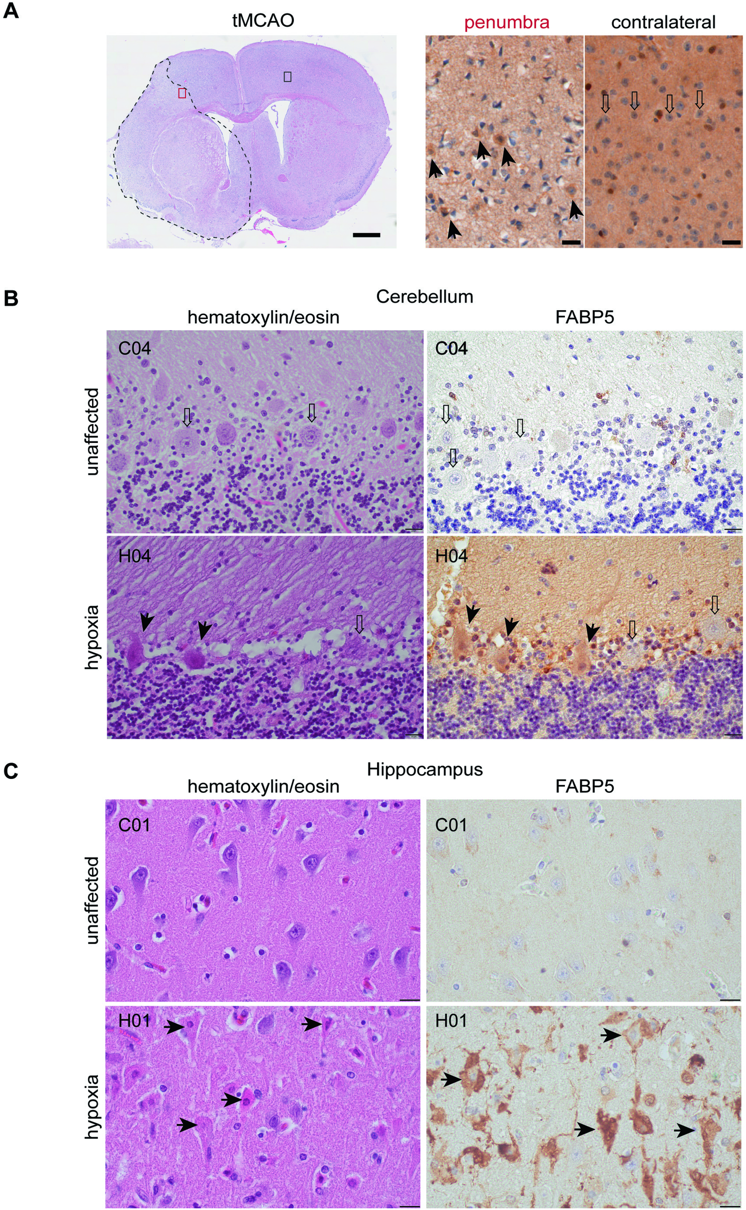 Fig. 6: FABP5 demarcates dying neurons in cortical and hippocampal sections with hypoxic damage.