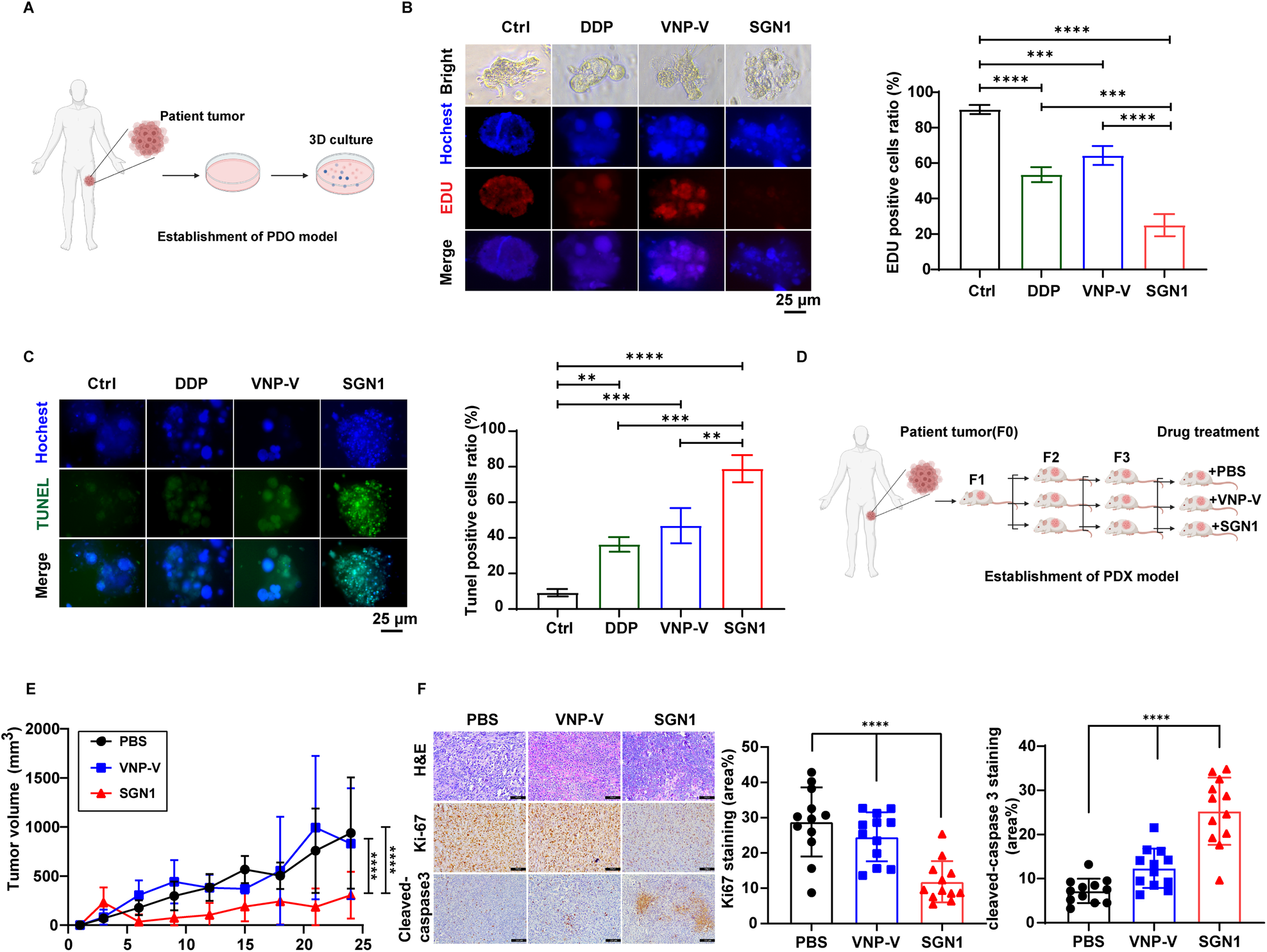 Fig. 2: Tumor-suppressive activity of SGN1 in osteosarcoma PDO and PDX models.