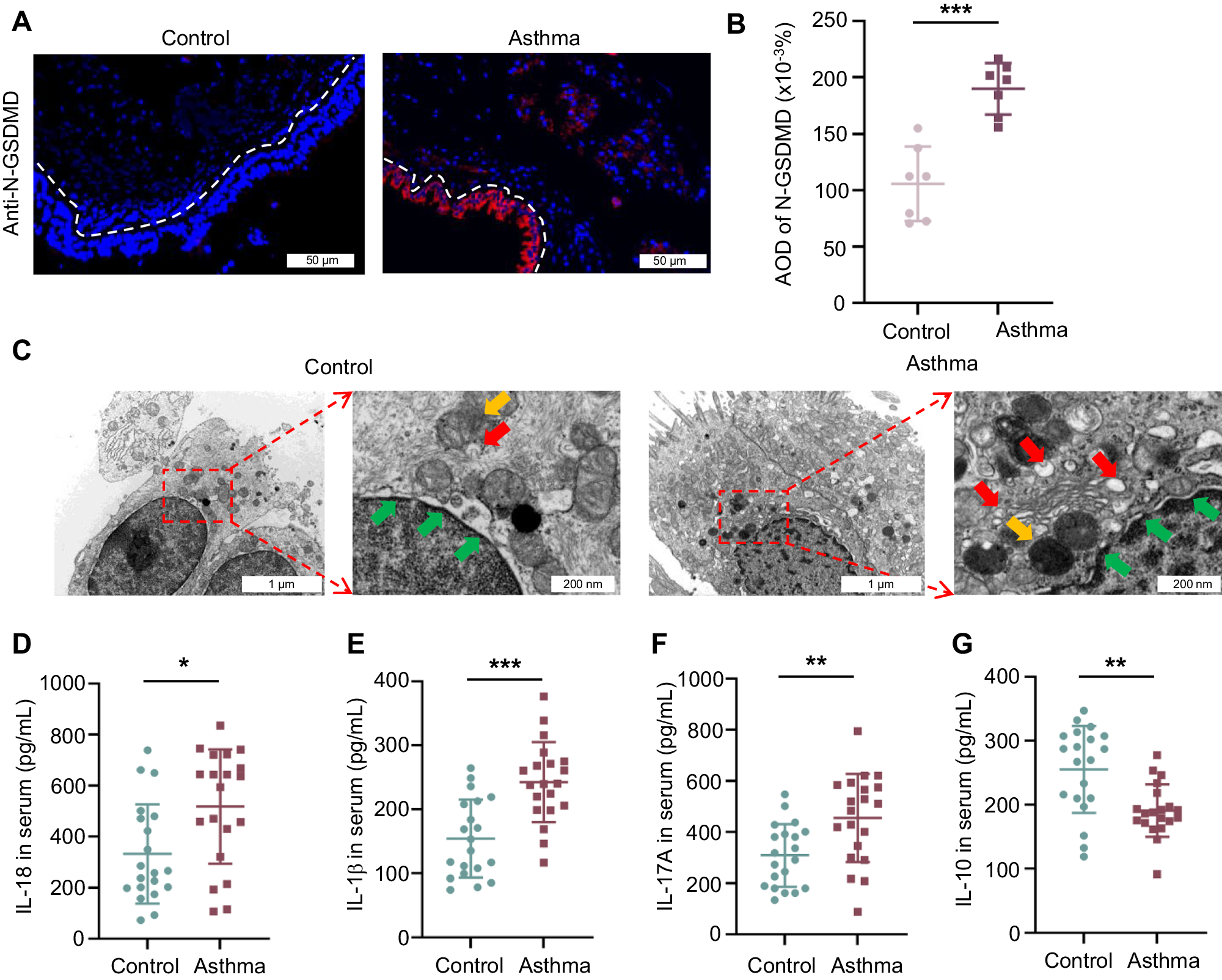 Fig. 1: Clinical implications of GSDMD-mediated pyroptosis in asthma.