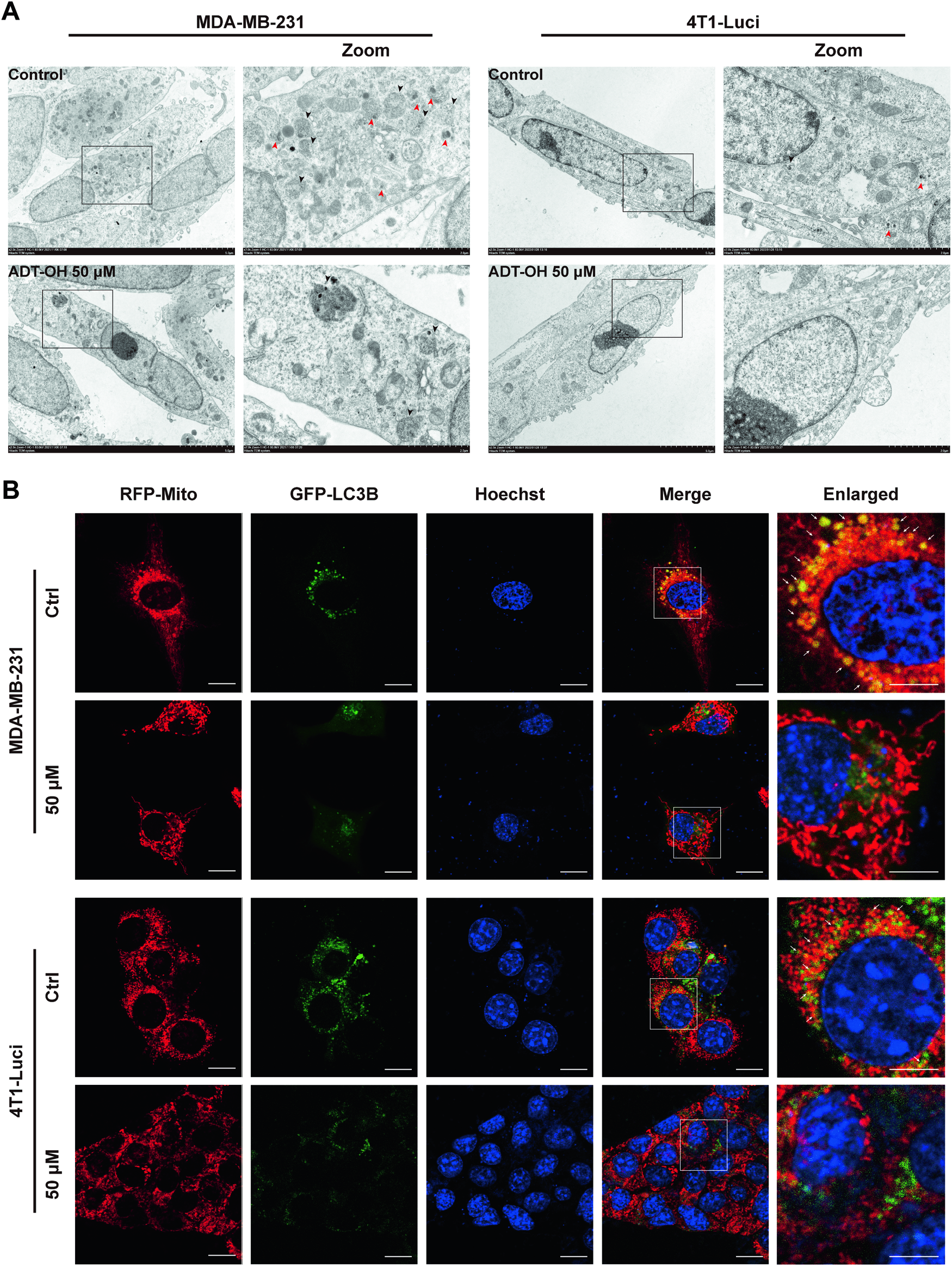 Fig. 6: Effects of ADT-OH on mitophagy in MDA-MB-231 and 4T1 cells.