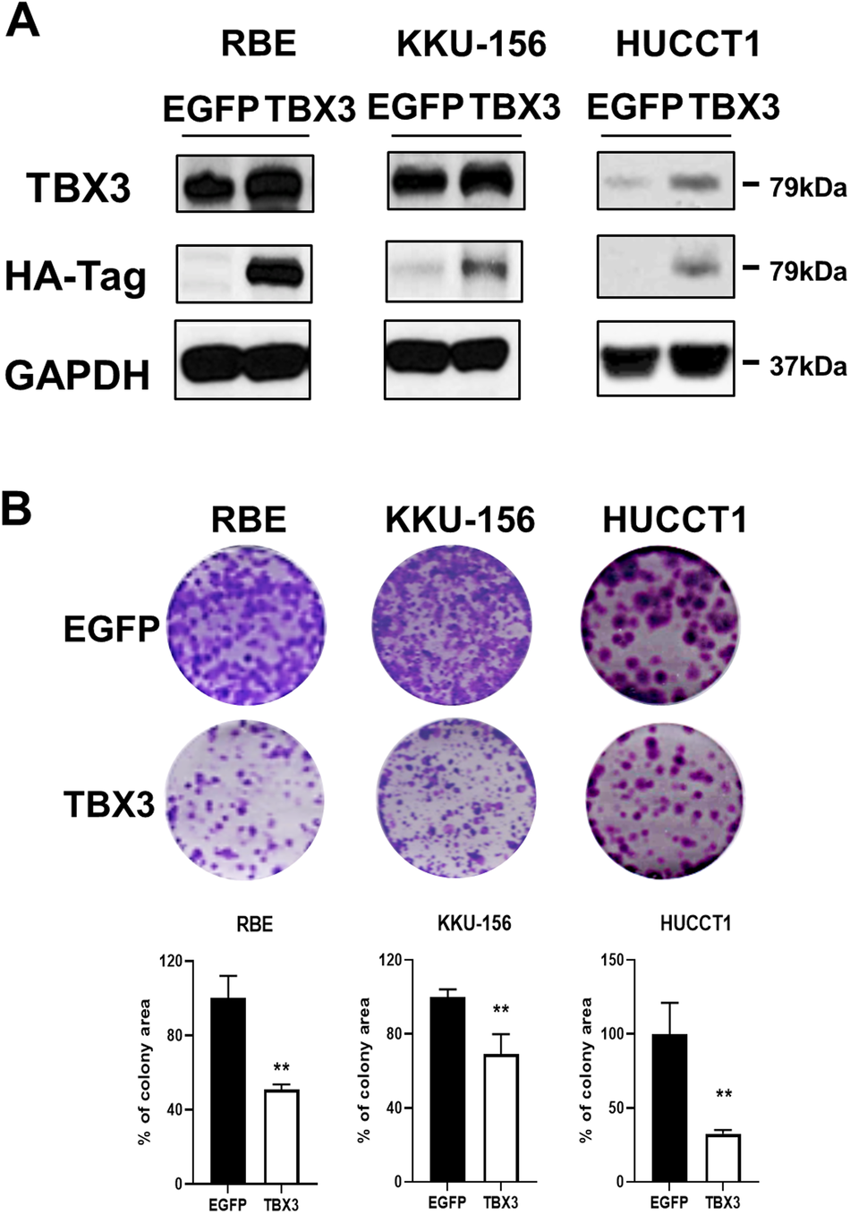 Overexpression of TBX3 suppresses tumorigenesis in experimental and human  cholangiocarcinoma | Cell Death & Disease