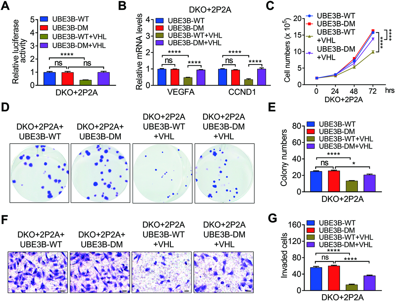 Fig. 6: VHL-mediated UBE3B ubiquitination is required for VHL’s inhibitory effect in breast cancer cells.