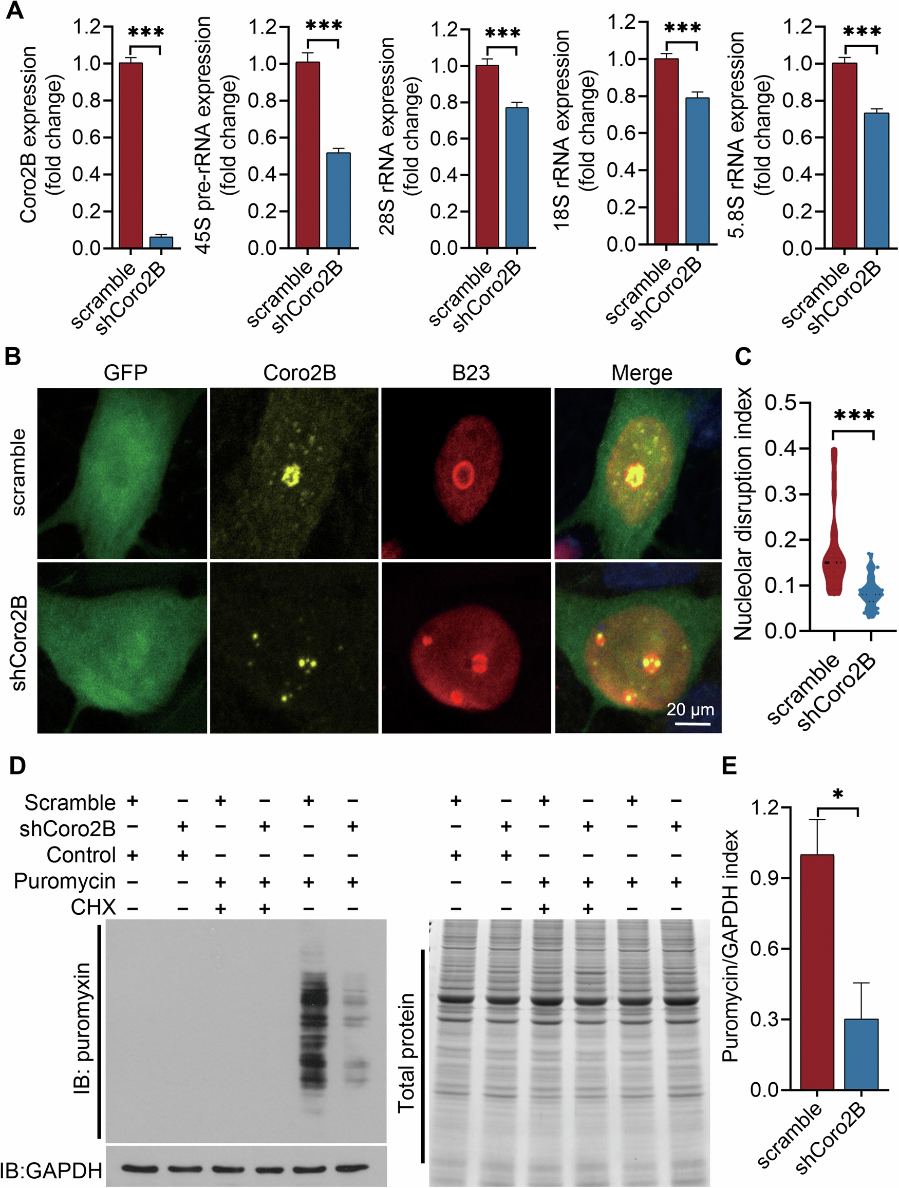Fig. 4: Coronin 2B knockdown triggers nucleolar stress.