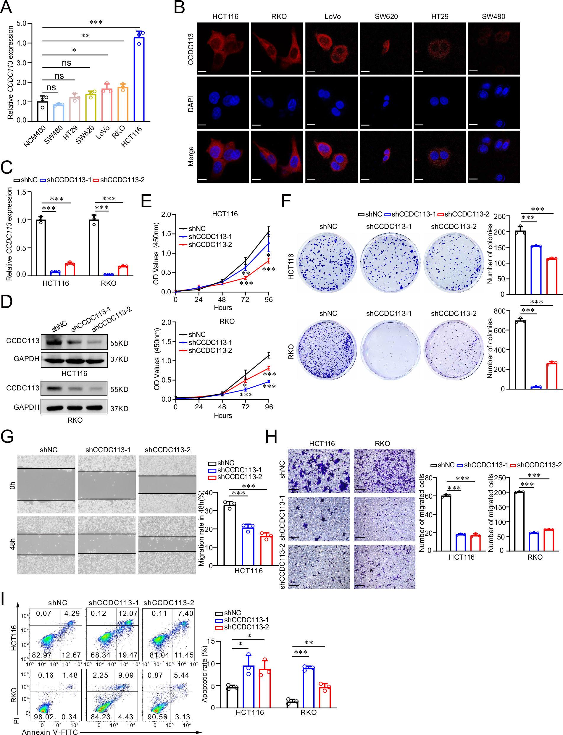 Fig. 3: CCDC113 knockdown inhibits CRC cells proliferation and migration in vitro.