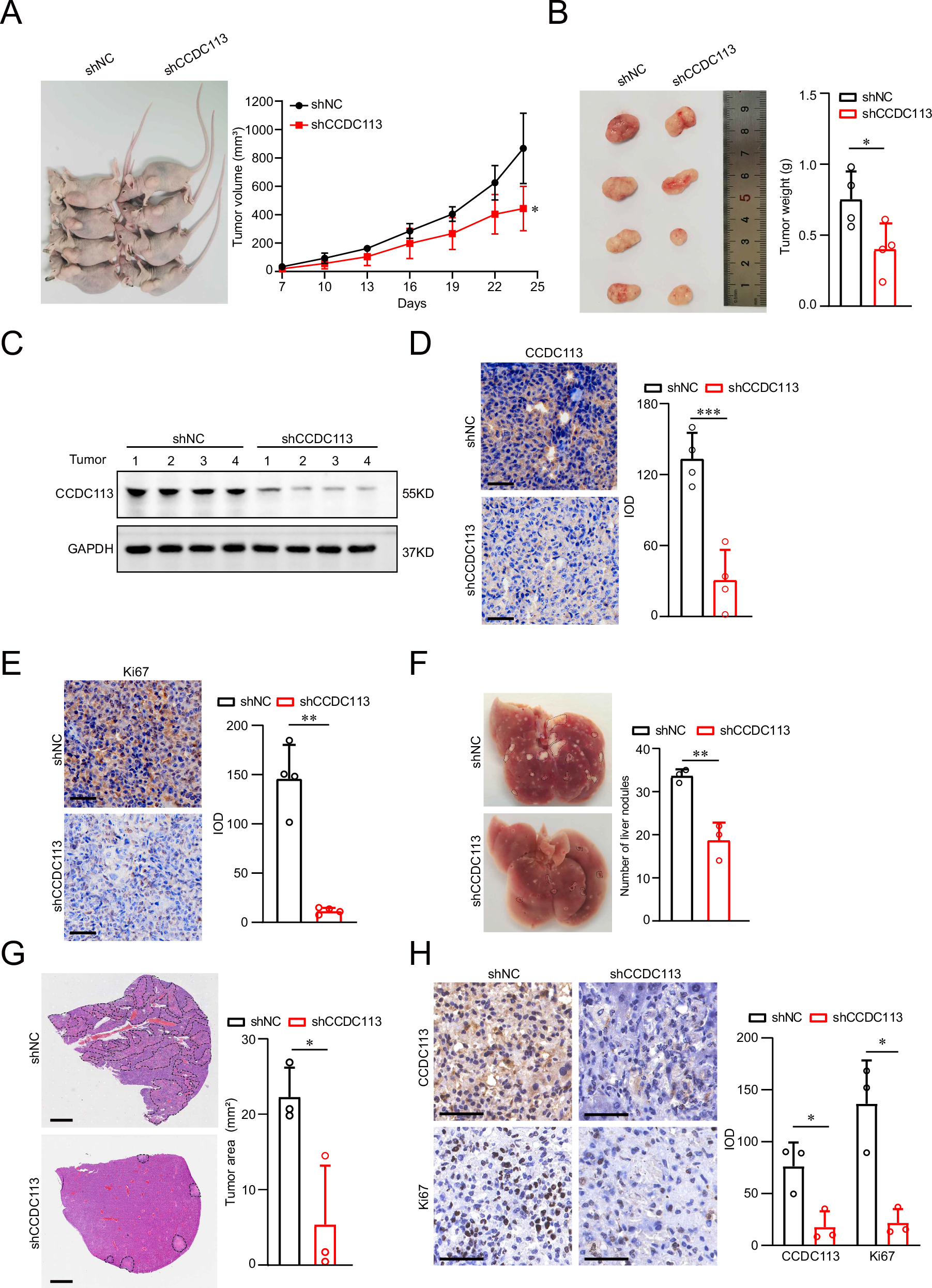 Fig. 4: CCDC113 knockdown inhibits CRC tumorigenesis and metastasis in vivo.