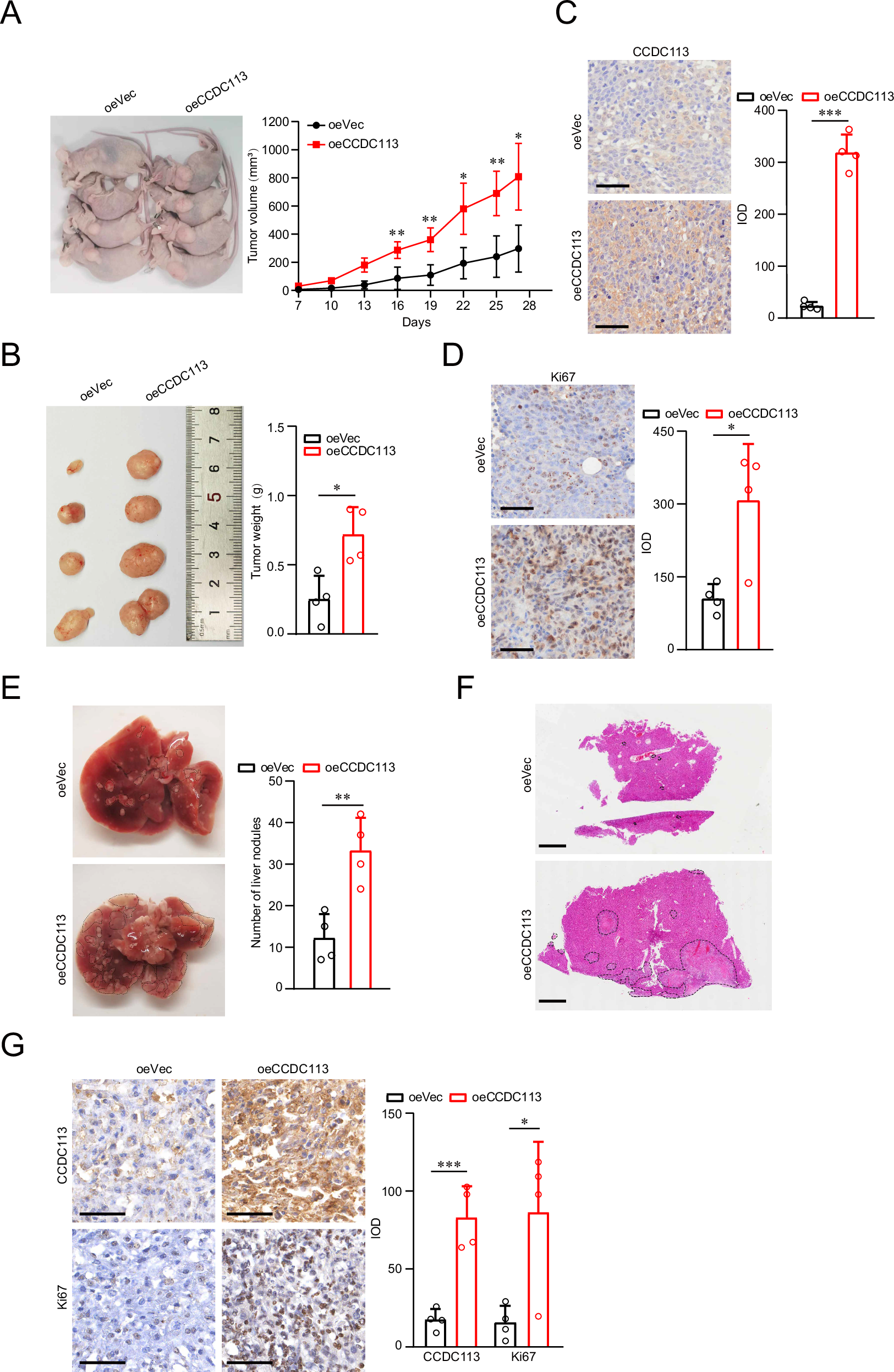 Fig. 6: CCDC113 overexpression promotes CRC tumorigenesis and metastasis in vivo.
