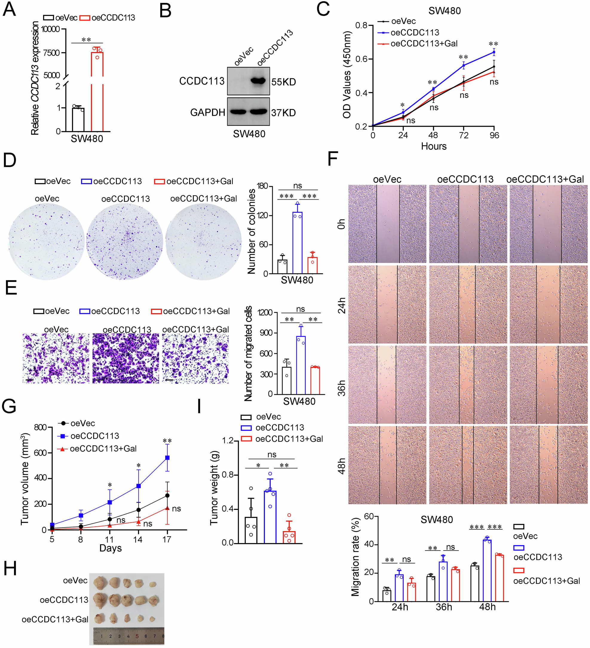 Fig. 8: Galunisertib reverses increased proliferation and migration abilities of CRC cells caused by CCDC113 overexpression in vitro and in vivo.