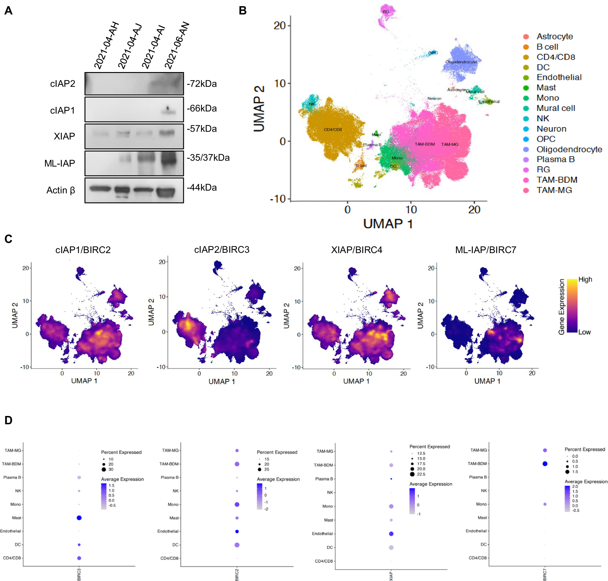 Fig. 1: Expression of cIAP1, cIAP2, XIAP and ML-IAP in human GB samples.
