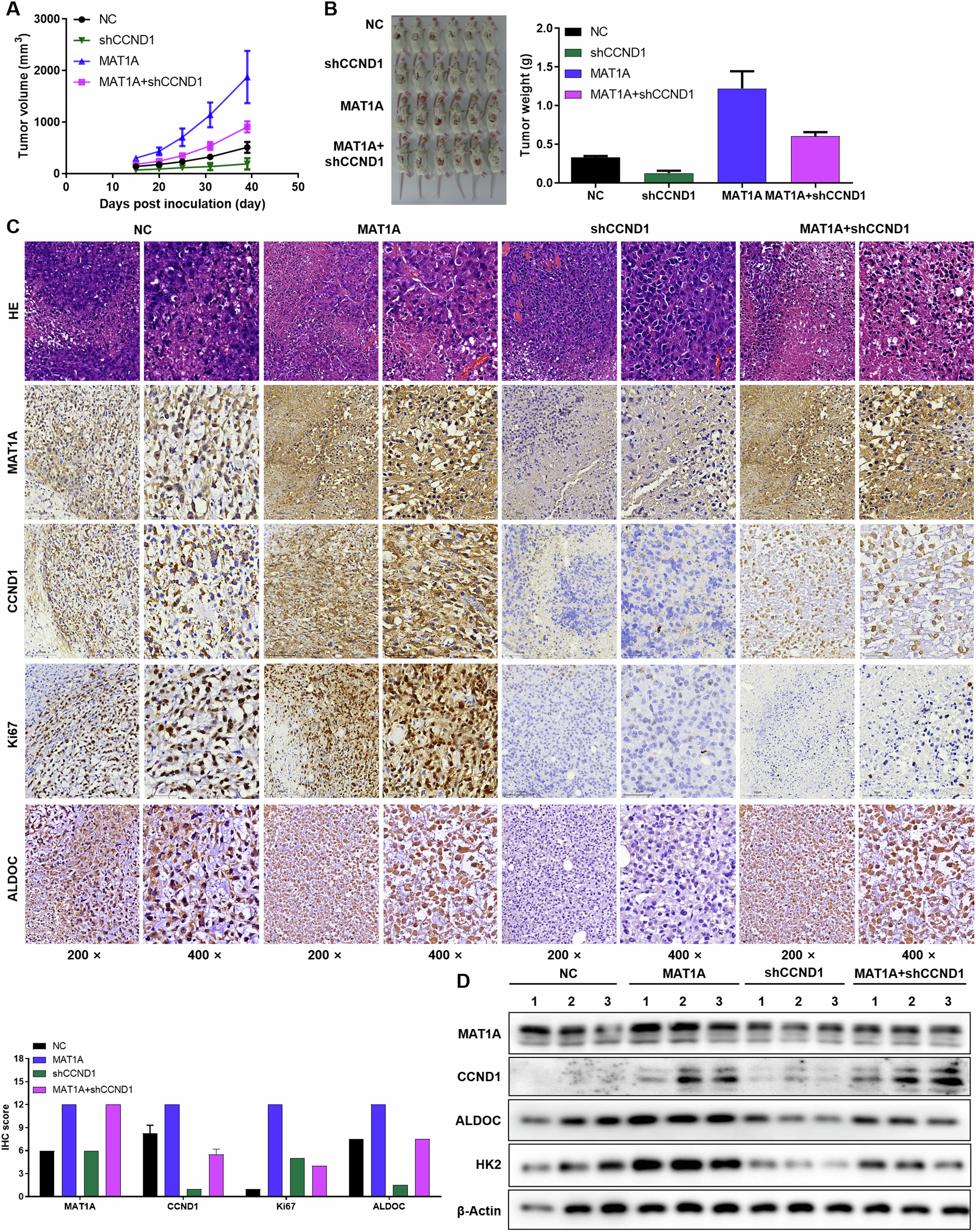 Fig. 6: The MAT1A/CCND1 signaling axis promotes glycolysis and tumorigenesis in NSCLC.