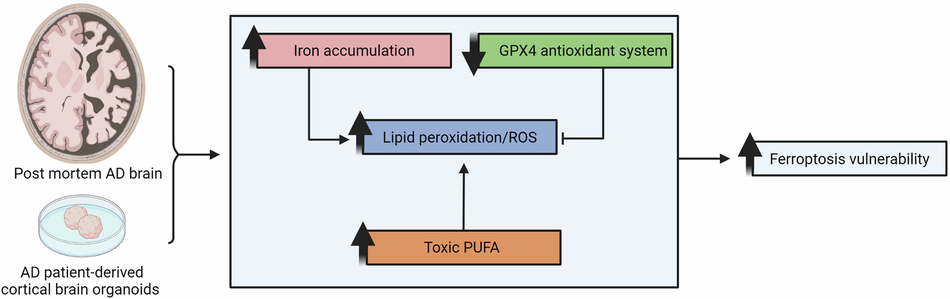 does glutathione affect alzheimer disease progression The link between amyloid β and ferroptosis pathway in Alzheimer's disease  progression