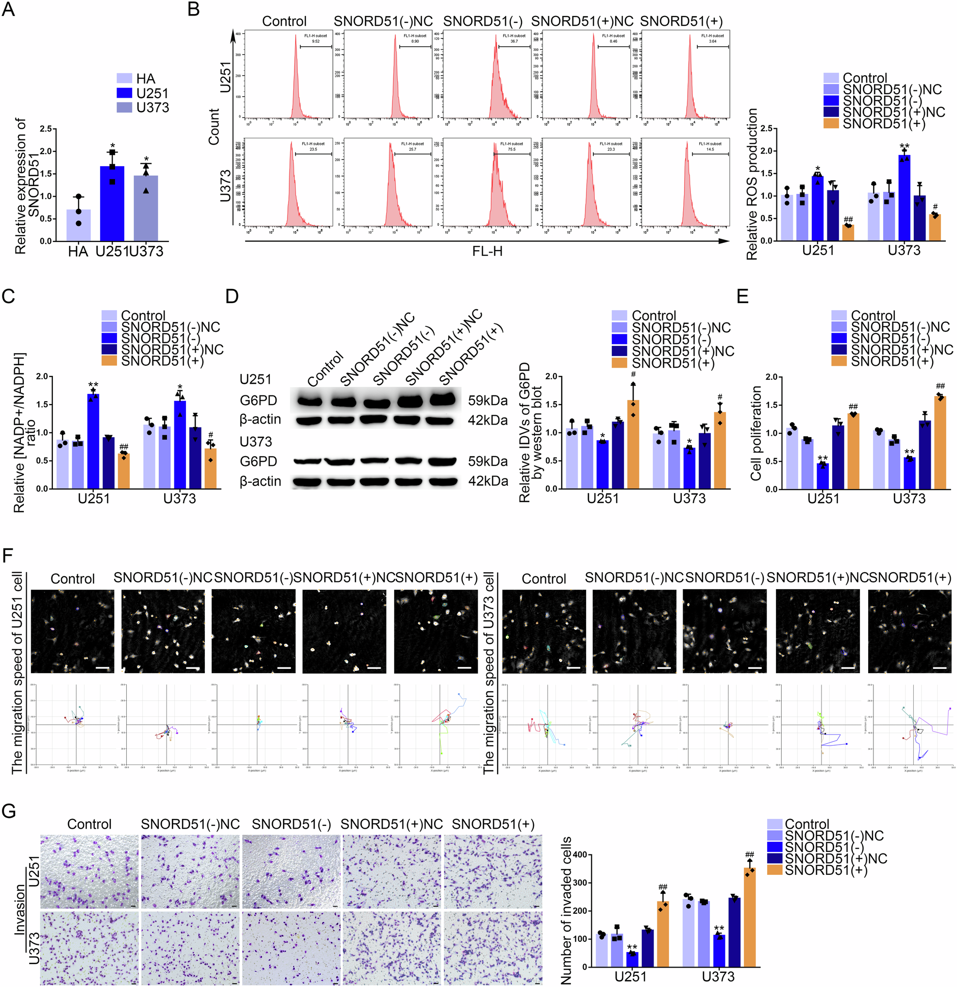 Fig. 2: SNORD51 was upregulated in GBM tissues and cells, promoting the PPP and biological behavior of GBM cells.