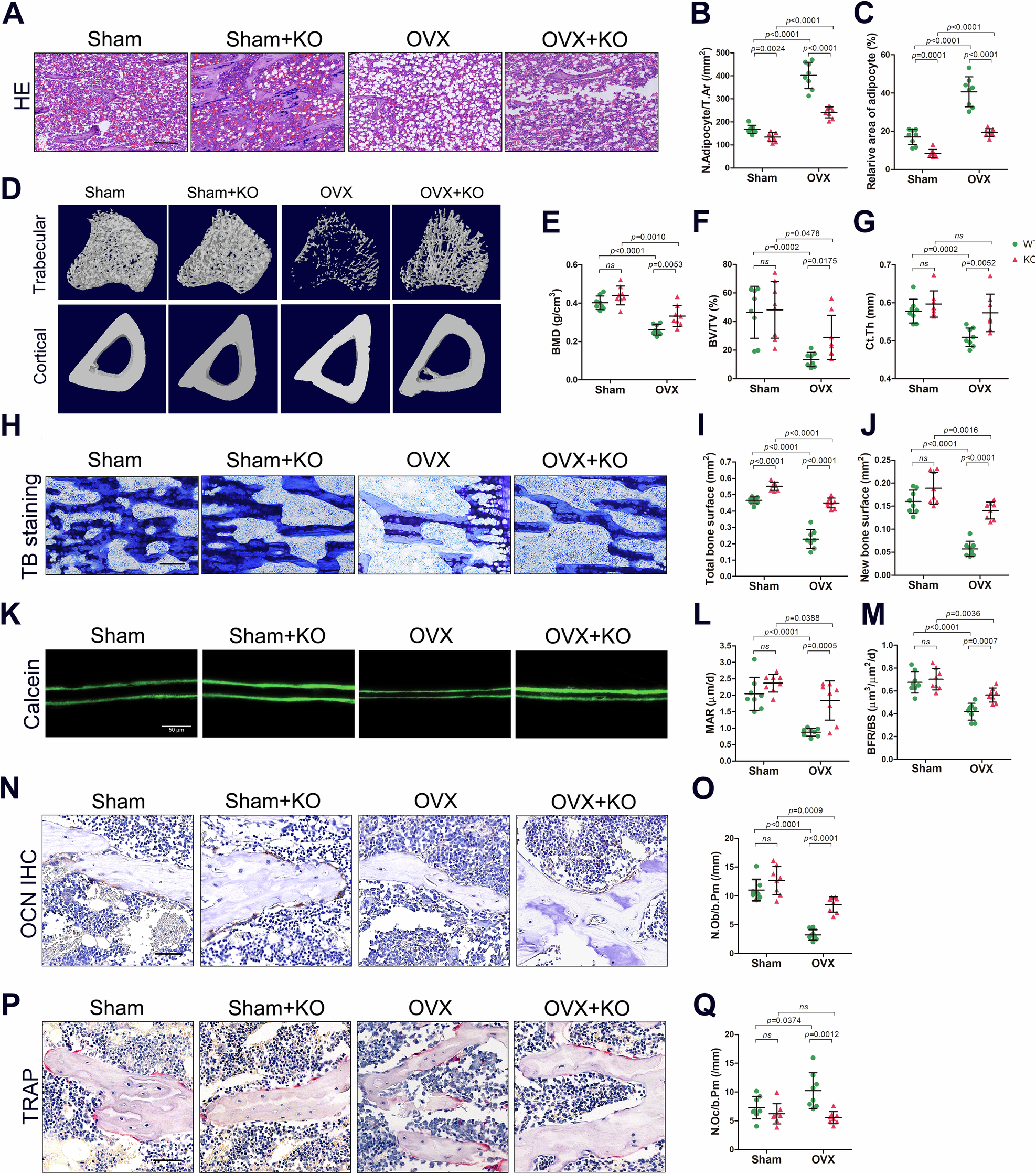 Fig. 2: Gmfb KO decreased BMAT and attenuated the osteoporotic phenotype in OVX-induced OP in vivo.