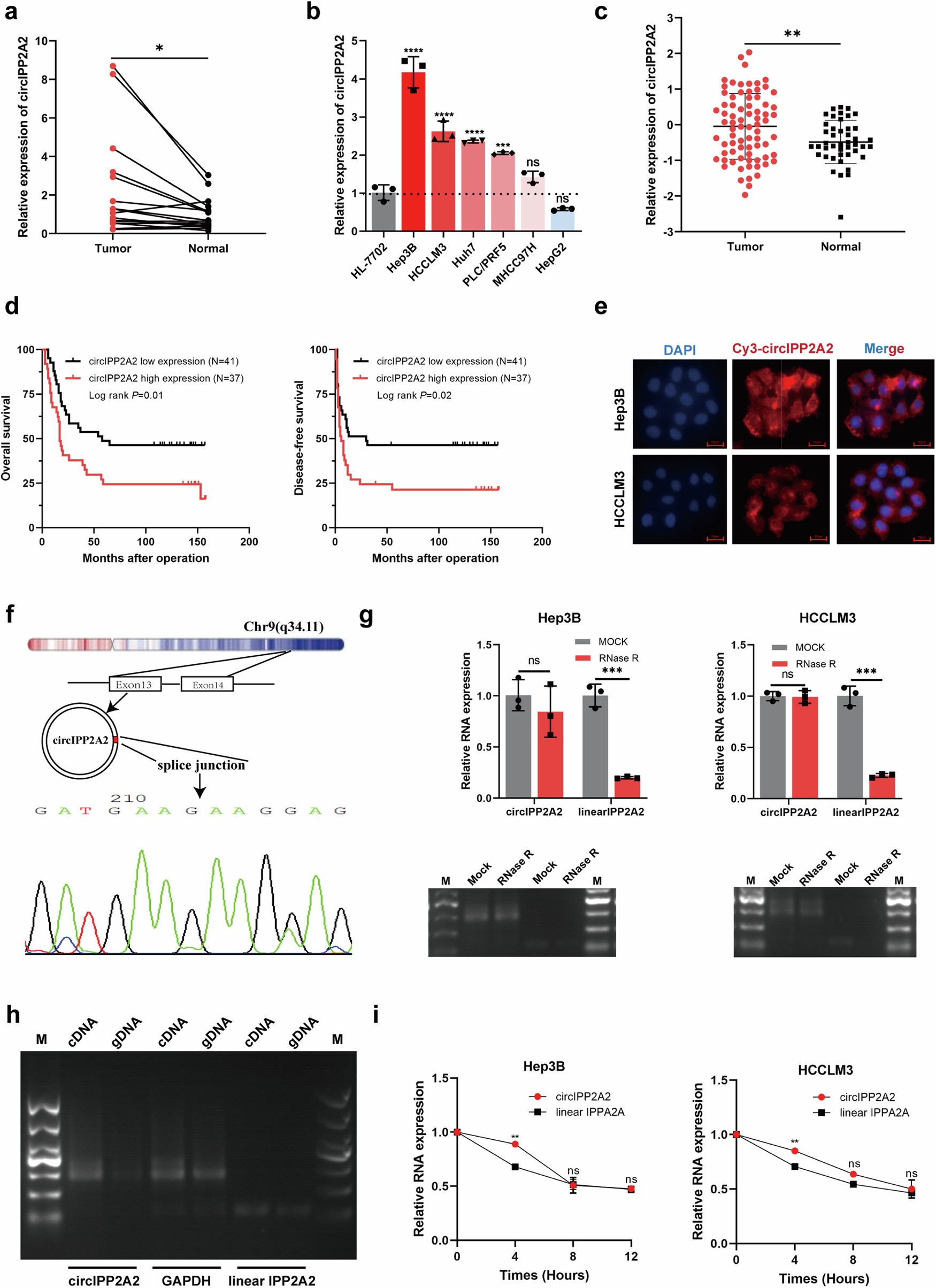 Fig. 2: The expression and characteristics of circIPP2A2.