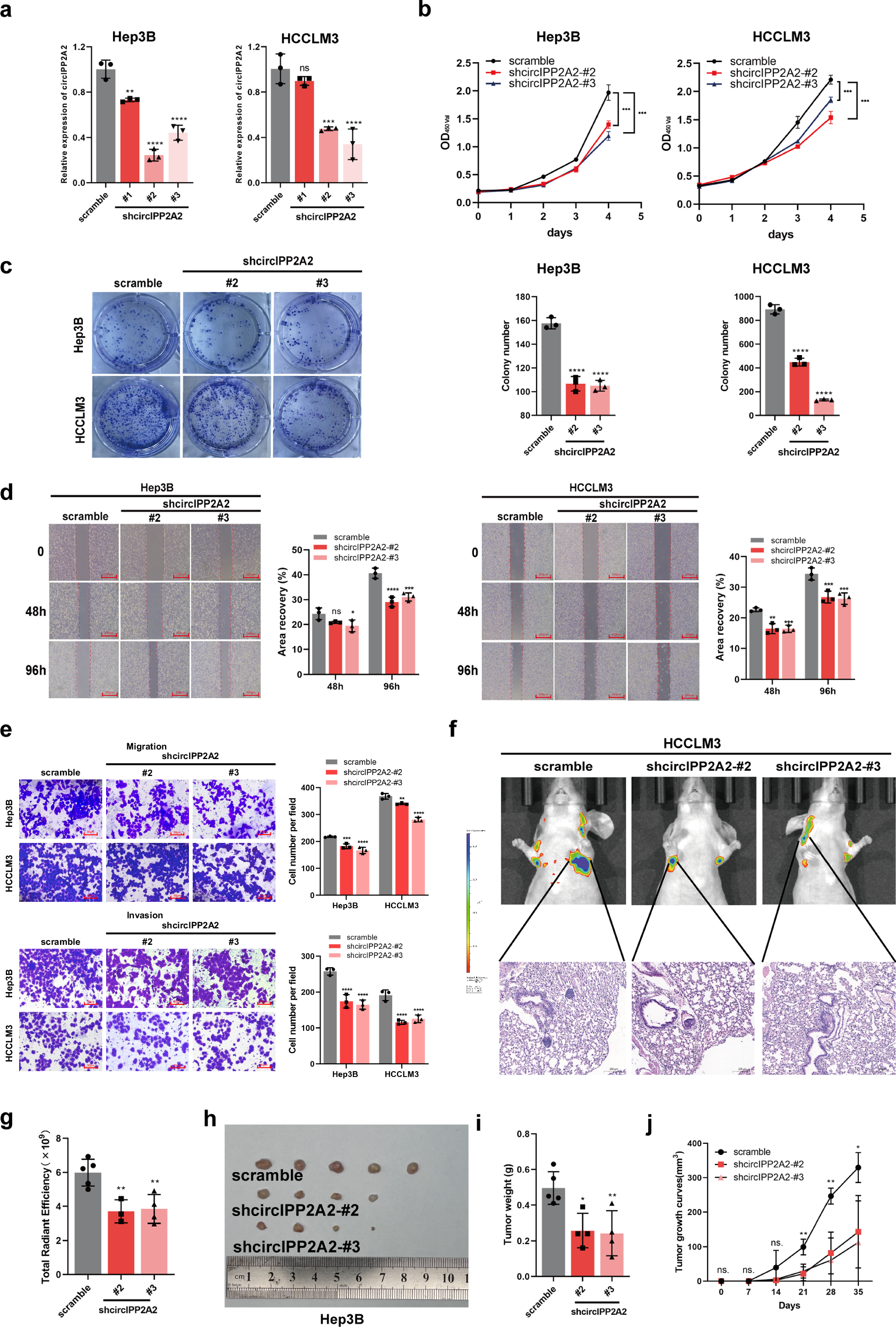 Fig. 3: circIPP2A2 downregulation suppressed HCC malignant behaviors in vitro and in vivo.