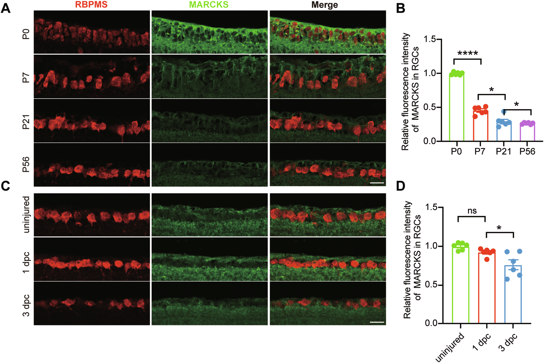 Marcks overexpression in retinal ganglion cells promotes optic nerve  regeneration | Cell Death & Disease