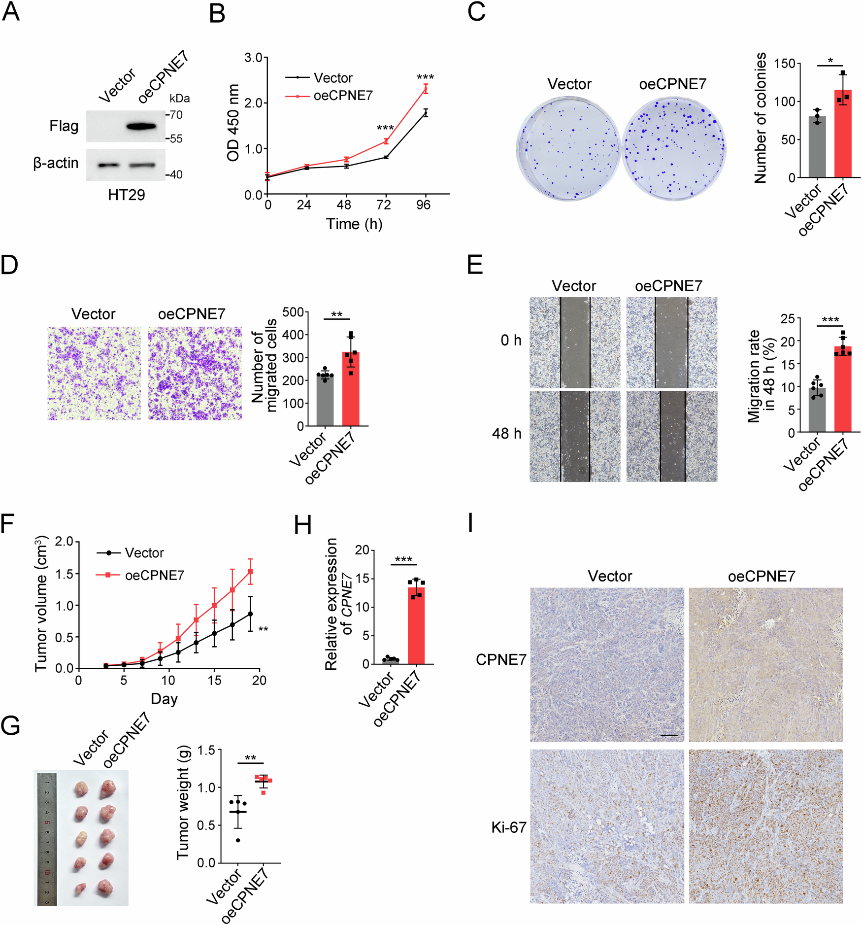 Fig. 4: CPNE7 overexpression promotes the proliferation and migration of CRC cells.