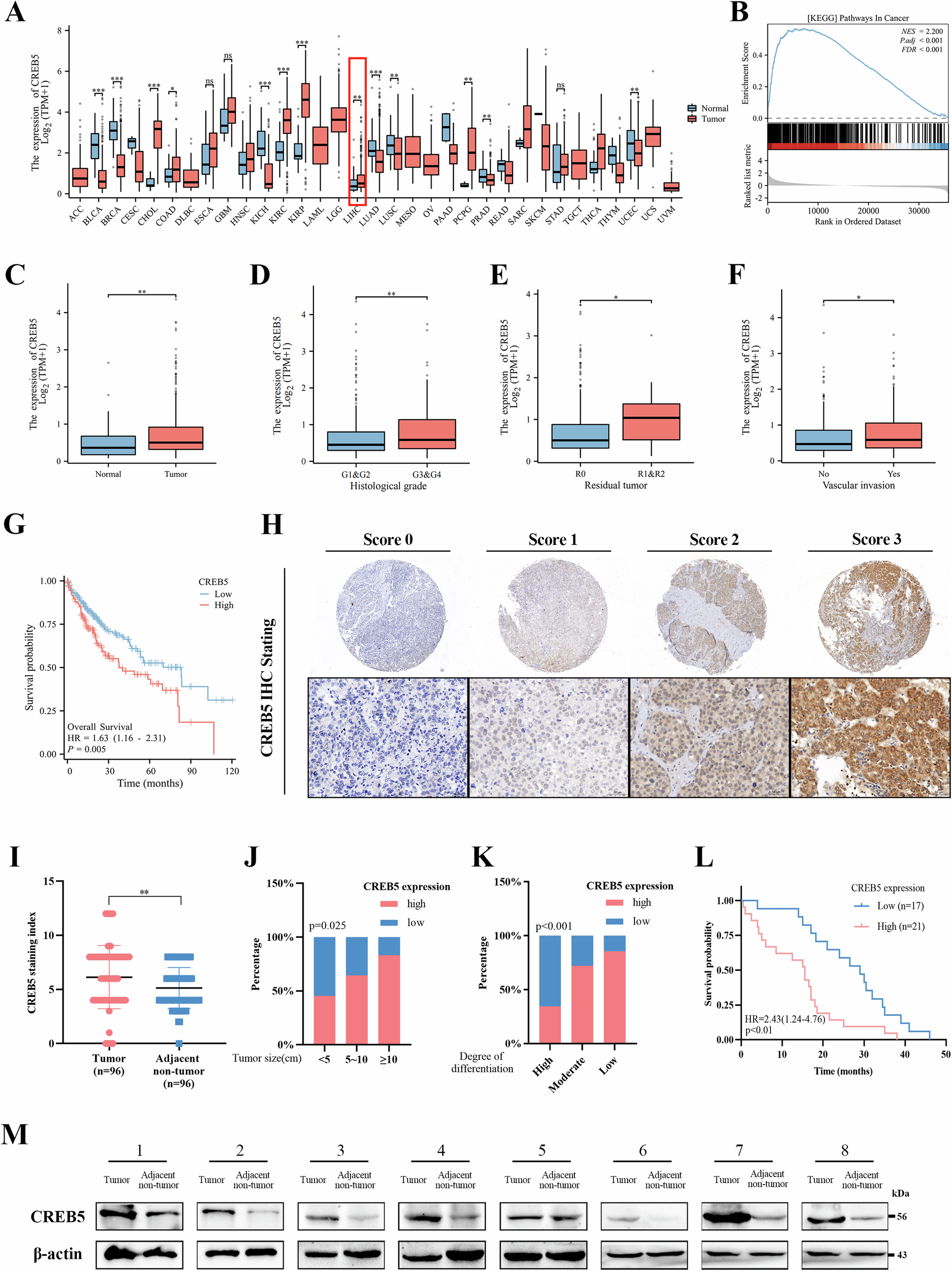 Fig. 2: CREB5 is highly expressed in HCC and associated with poor prognosis.