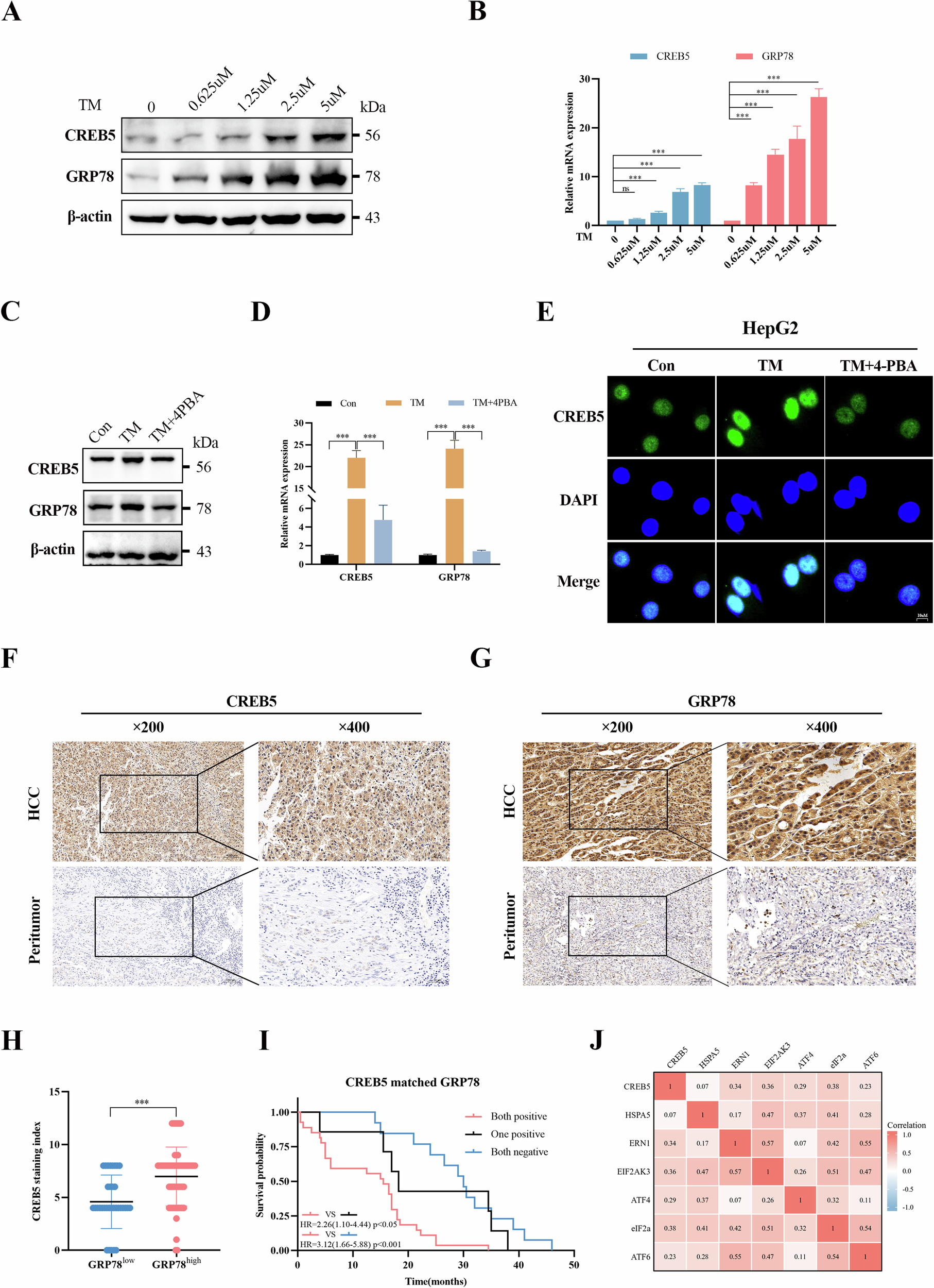 Fig. 3: Activation of ERS upregulates CREB5 expression in HCC.