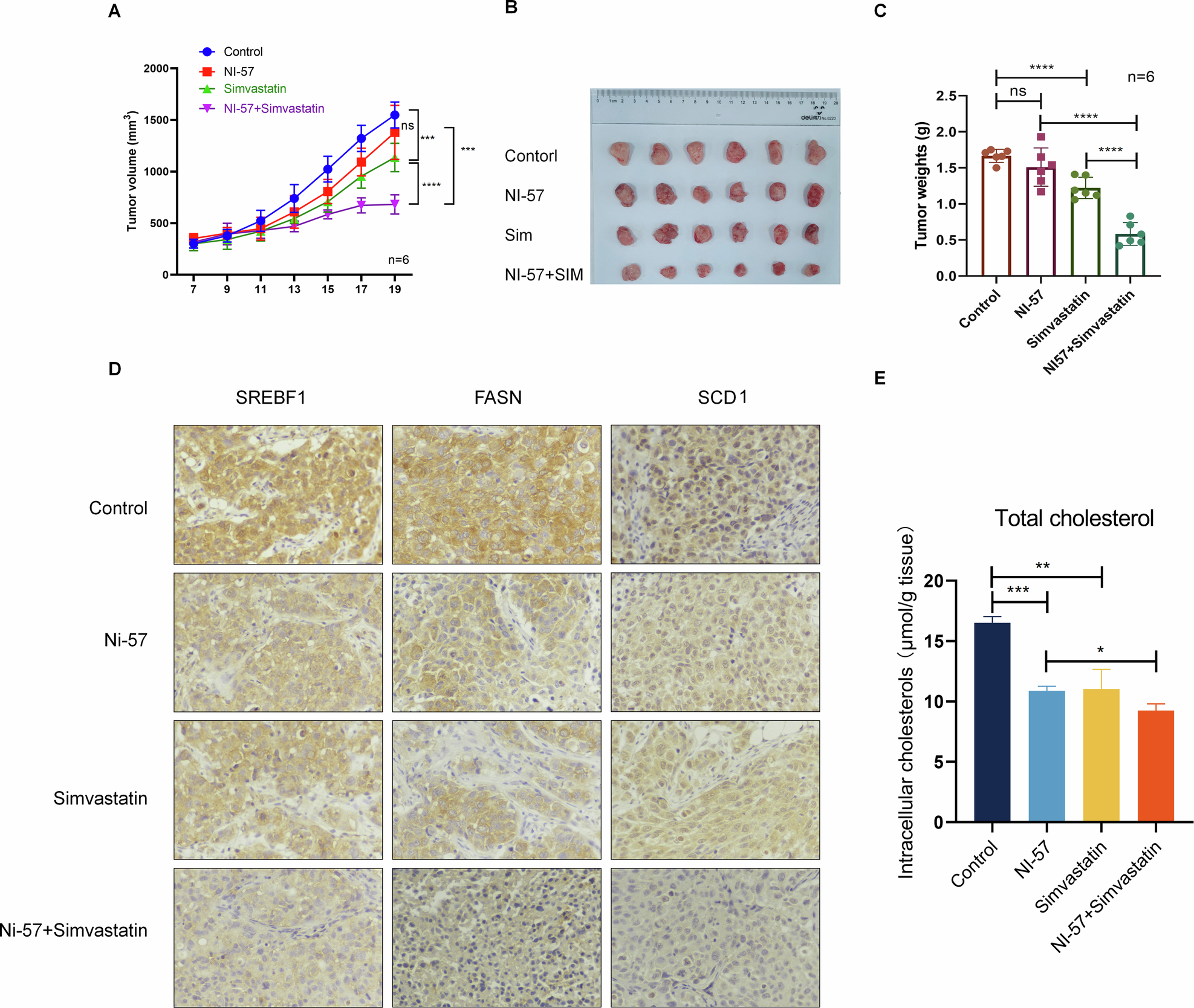 Fig. 6: BRD1 inhibitor combined with Simvastatin synergically inhibit HCC progression.