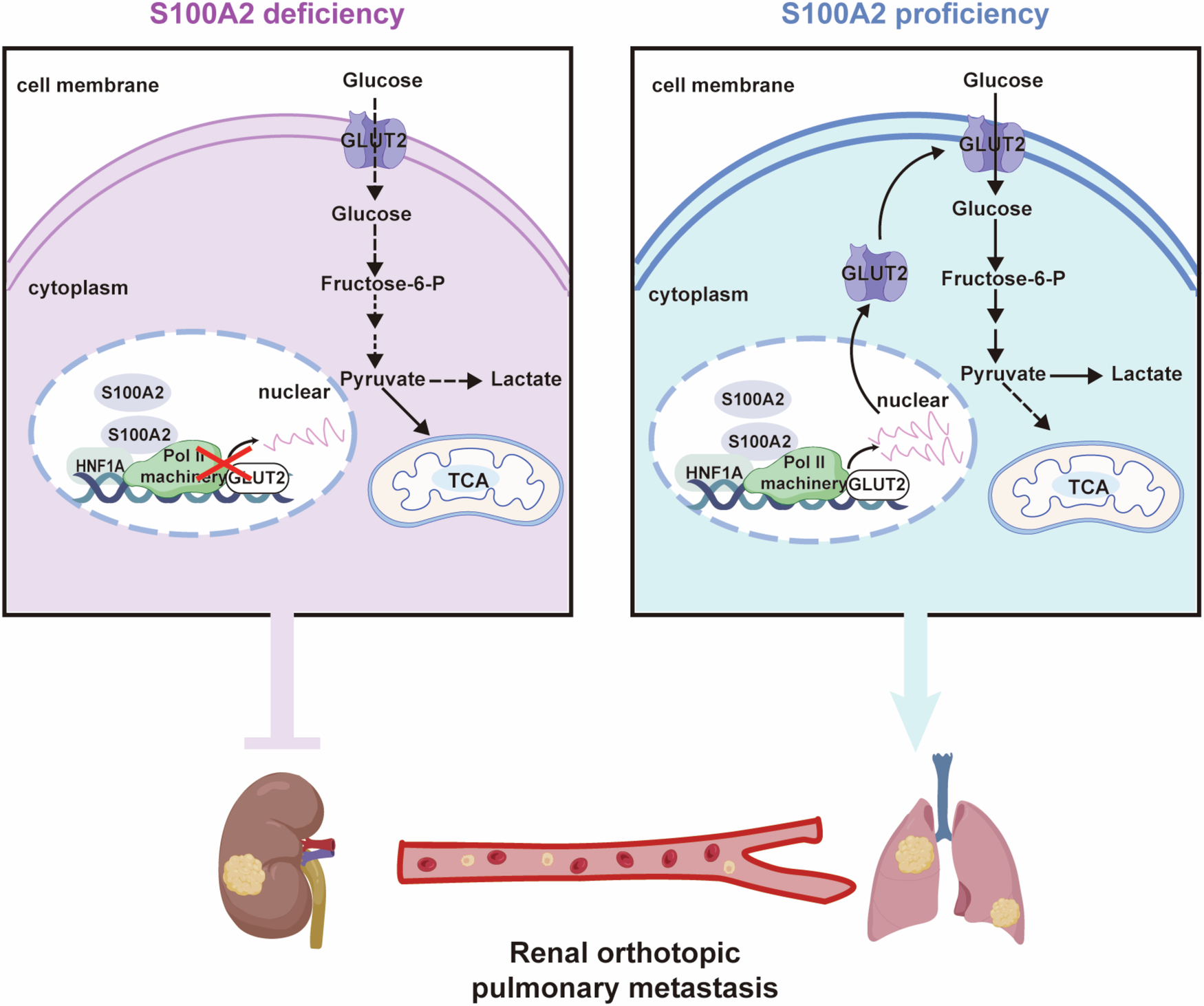 Fig. 7: Schematic model of the mechanism of S100A2-HNF1A-GLUT2 axis in ccRCC metastasis.