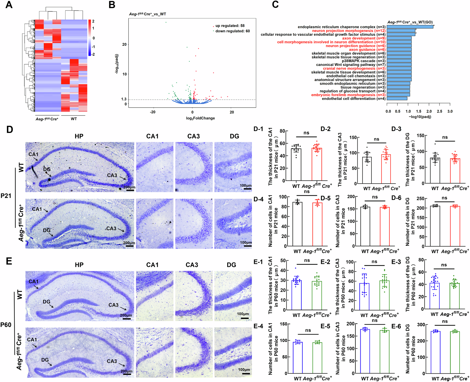Fig. 6: Aeg-1 deficiency leads to abnormal hippocampal neuronal morphology without altering hippocampal thickness or cell numbers.