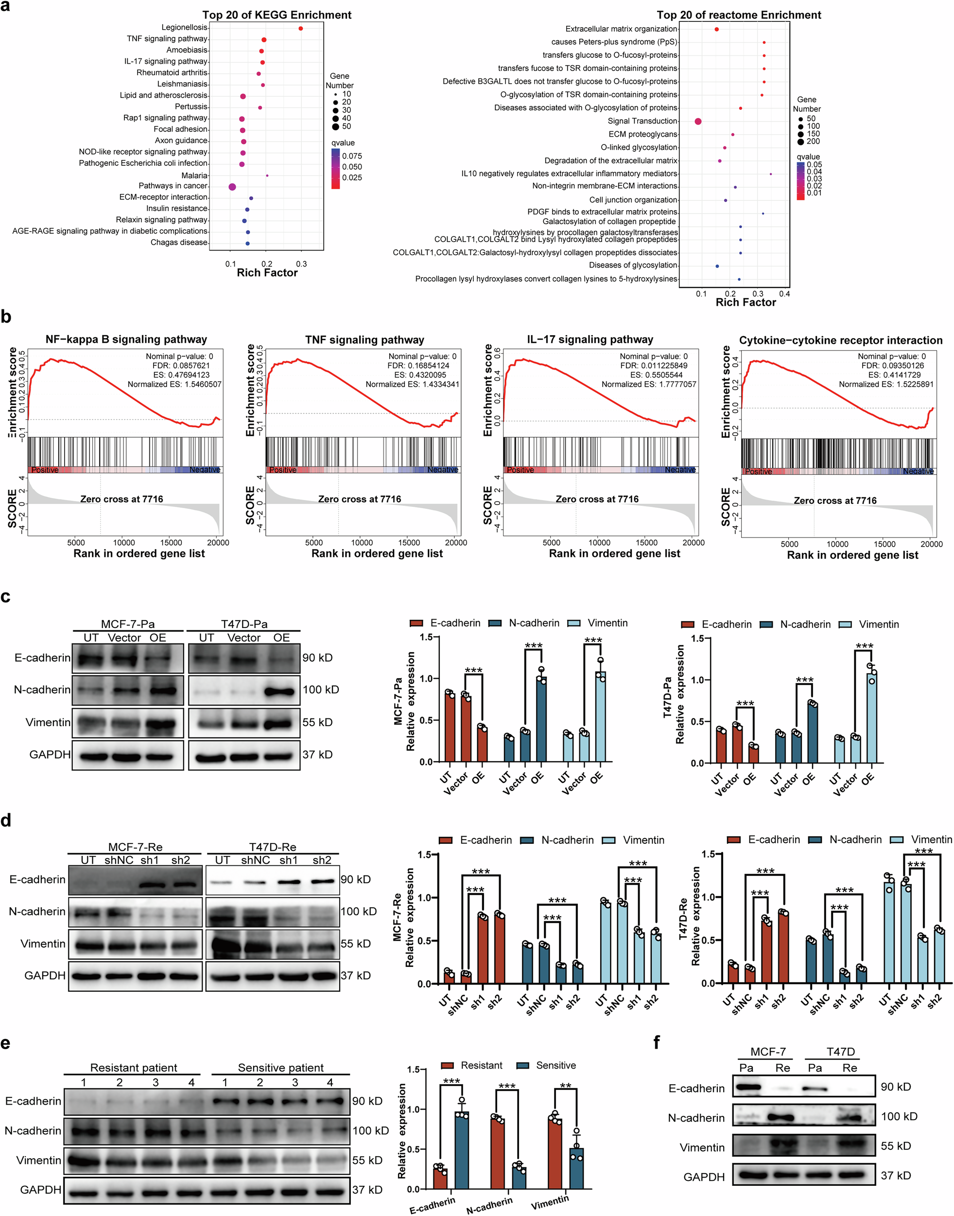 Fig. 4: MMP1-induced EMT and proliferation via NF-κB pathway activation in BC cells.