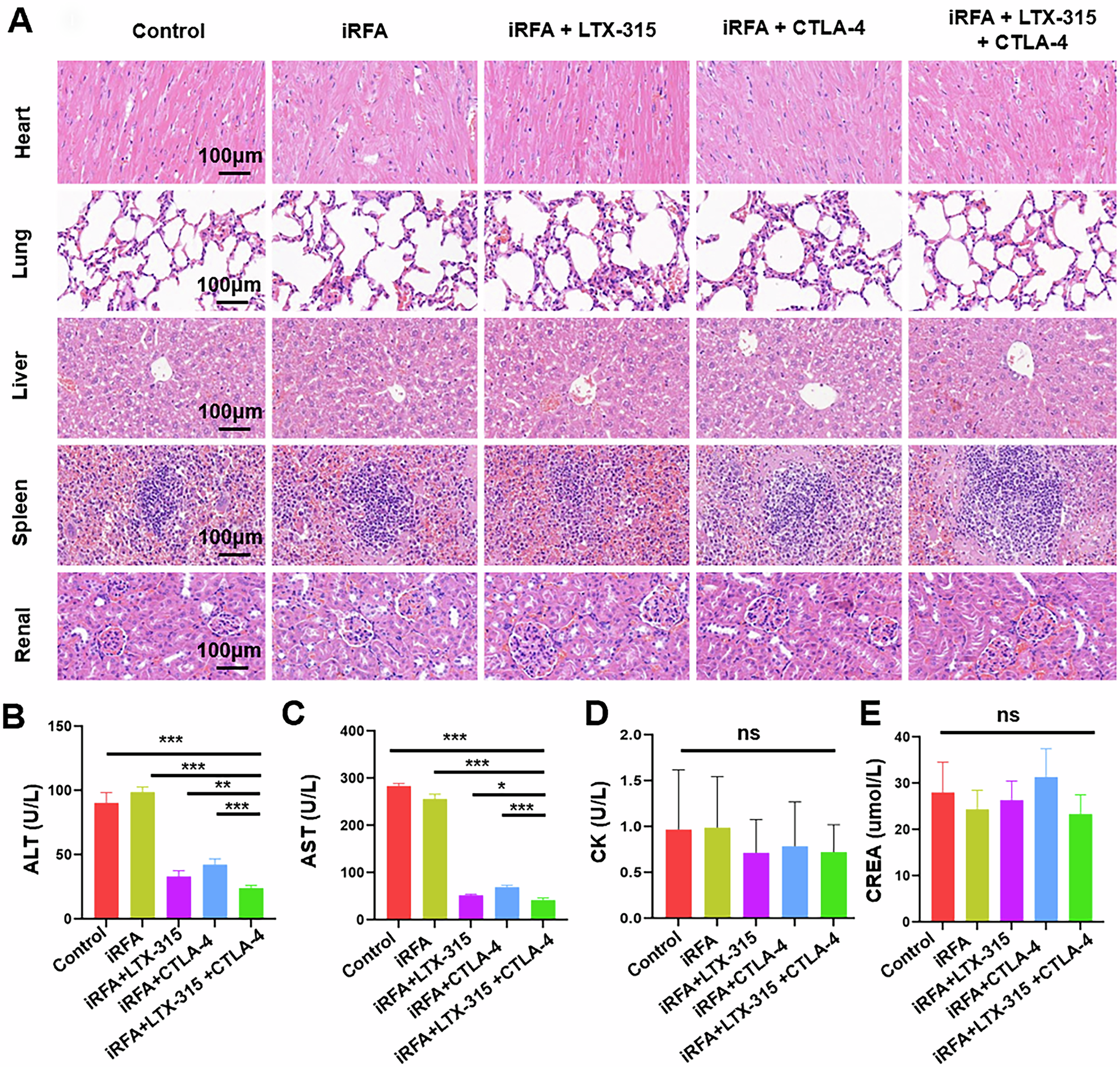 Fig. 8: The safety assessment of the triple combination treatment (iRFA + LTX-315 + anti-CTLA-4 antibody) for HCC.