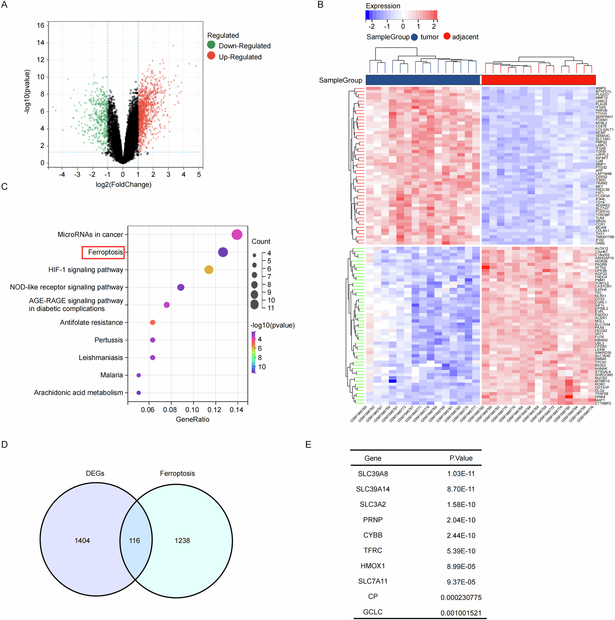 Fig. 1: Identification of ZIP8 as a significant factor in ESCC and ferroptosis.