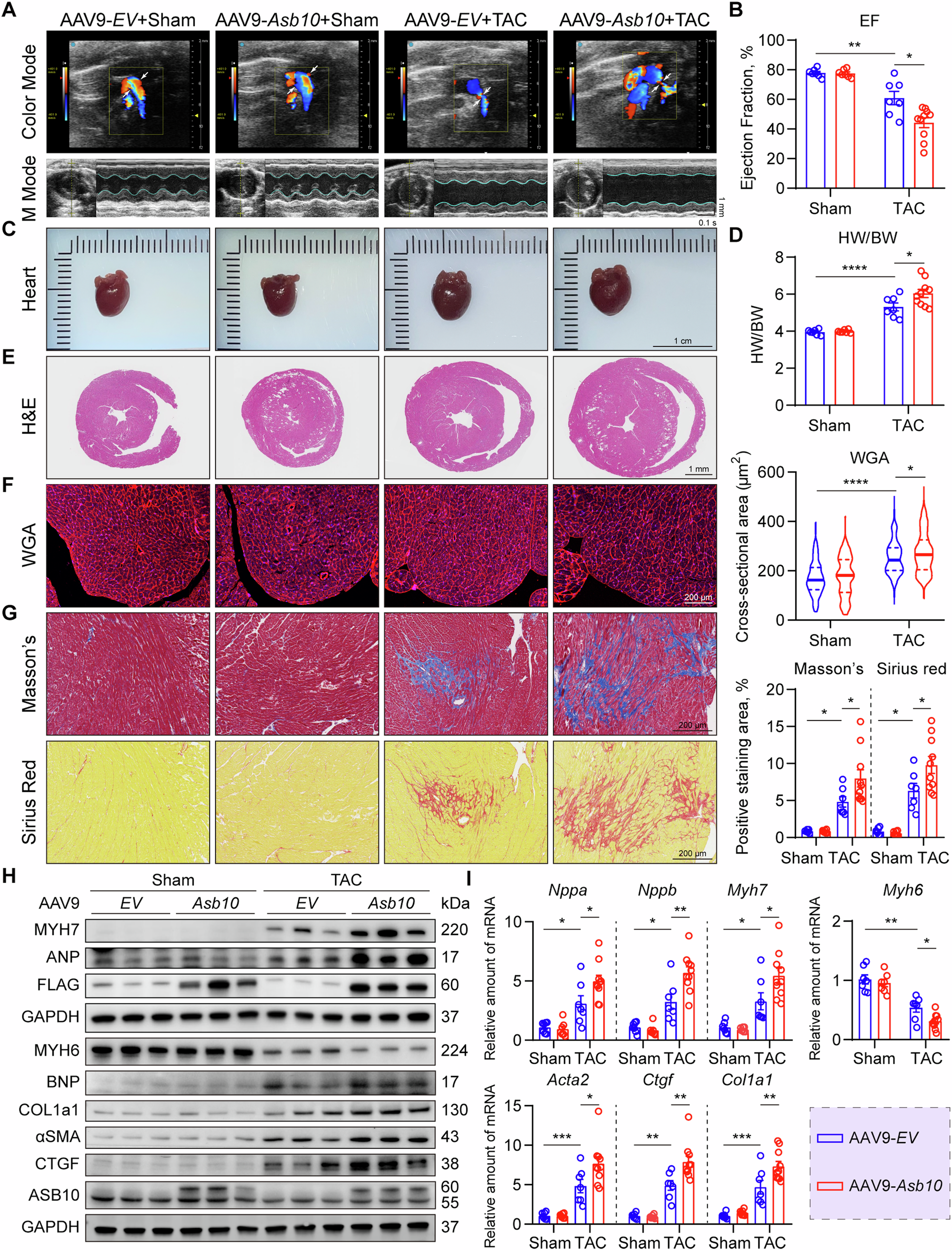 Fig. 6: Cardiac overexpression of Asb10 deteriorates pathological cardiac hypertrophy under pressure overload.