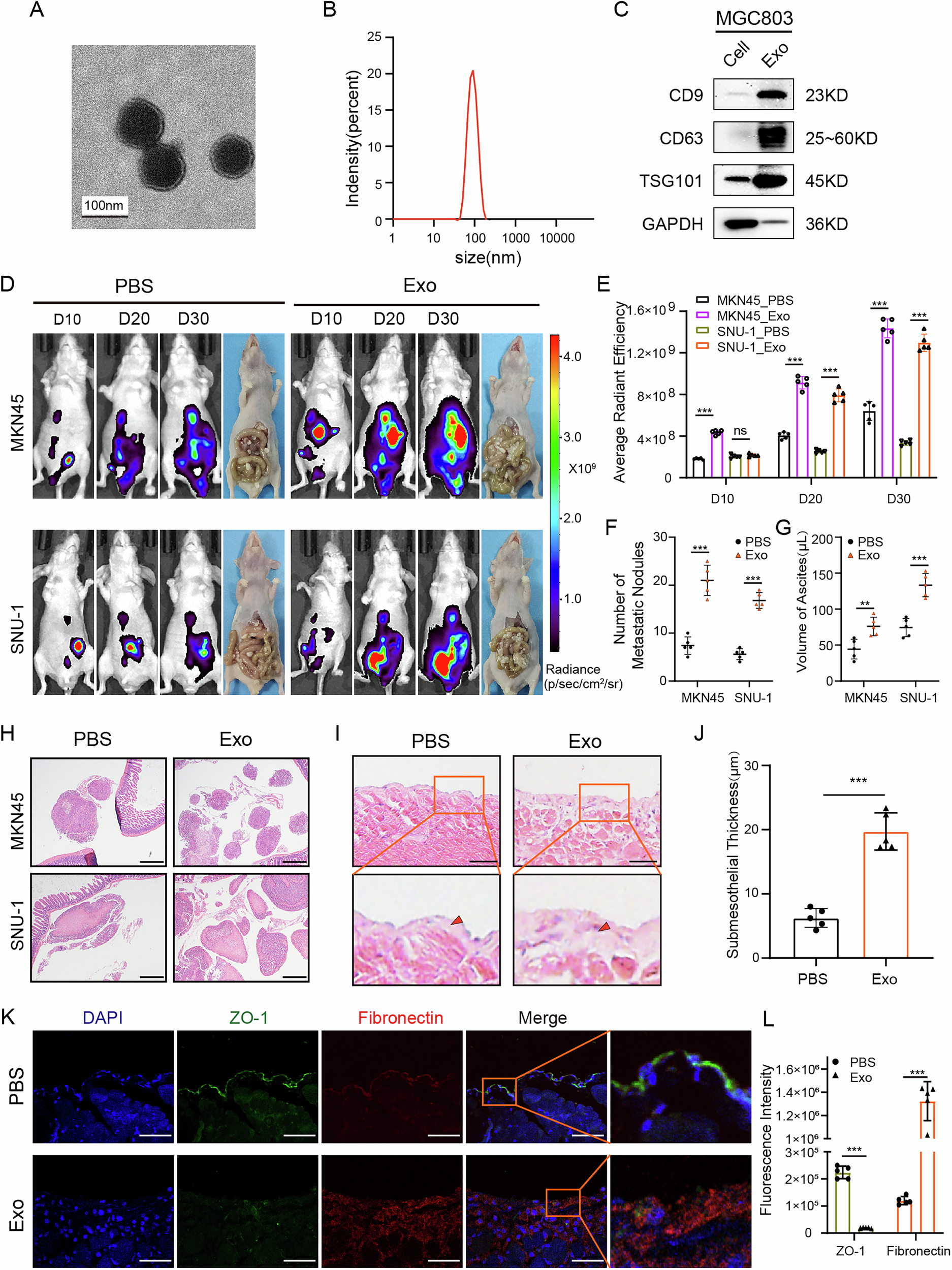 Fig. 1: GC cell-derived exosomes promoted GCPM in vivo.